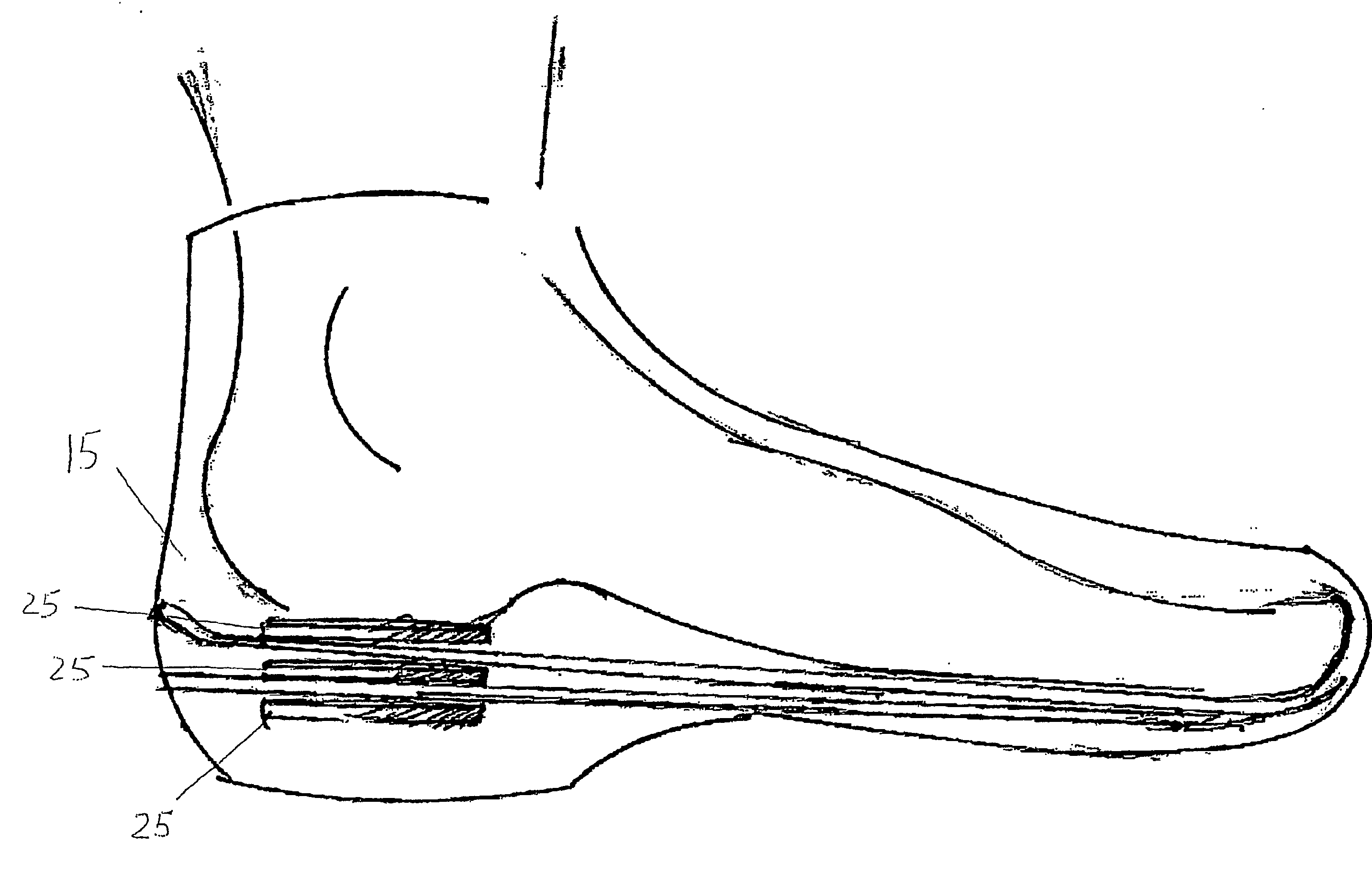 Functional electrical stimulation systems