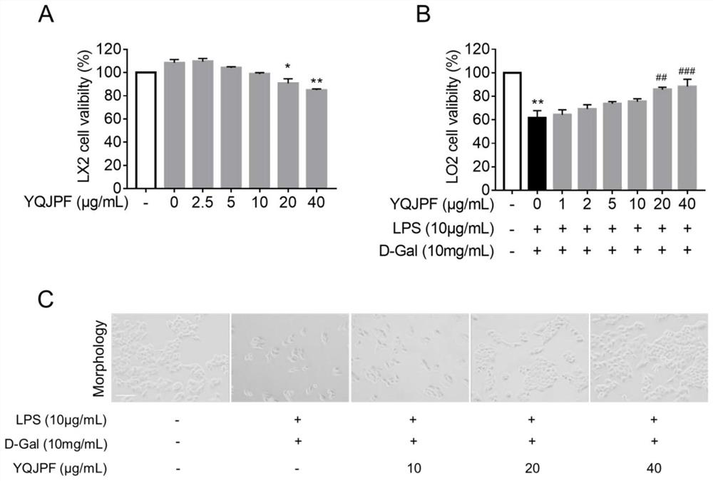 Anti-hepatic fibrosis traditional Chinese medicine compound composition and application thereof