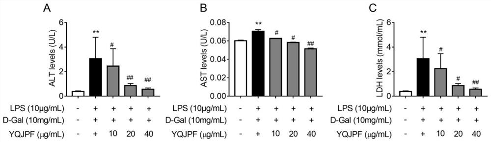 Anti-hepatic fibrosis traditional Chinese medicine compound composition and application thereof