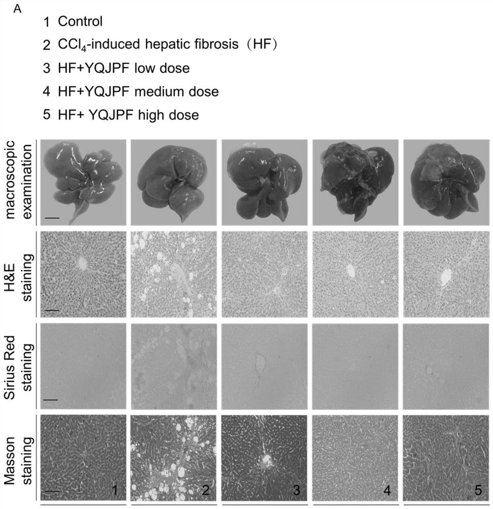 Anti-hepatic fibrosis traditional Chinese medicine compound composition and application thereof