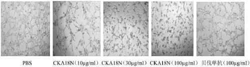 Polypeptide CKA18N for inhibiting angiogenesis and application thereof