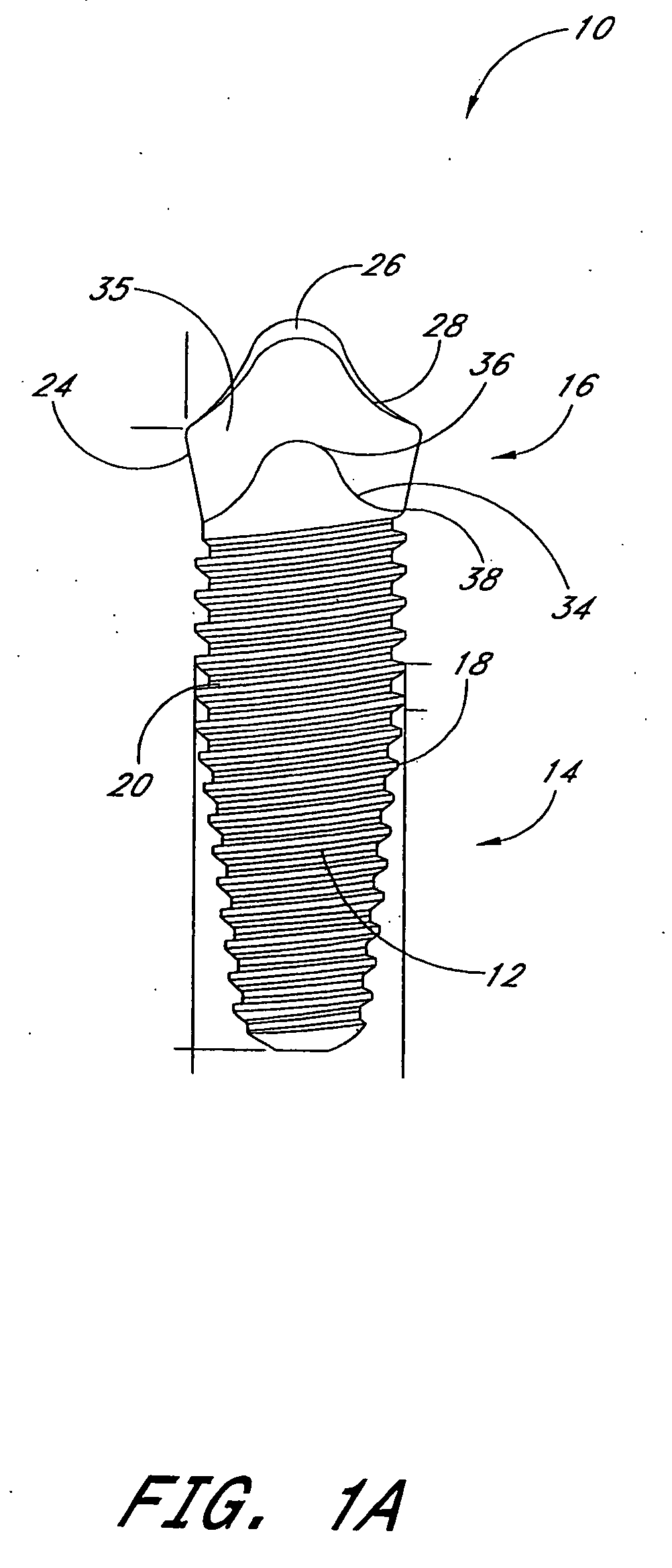 Dental implant system