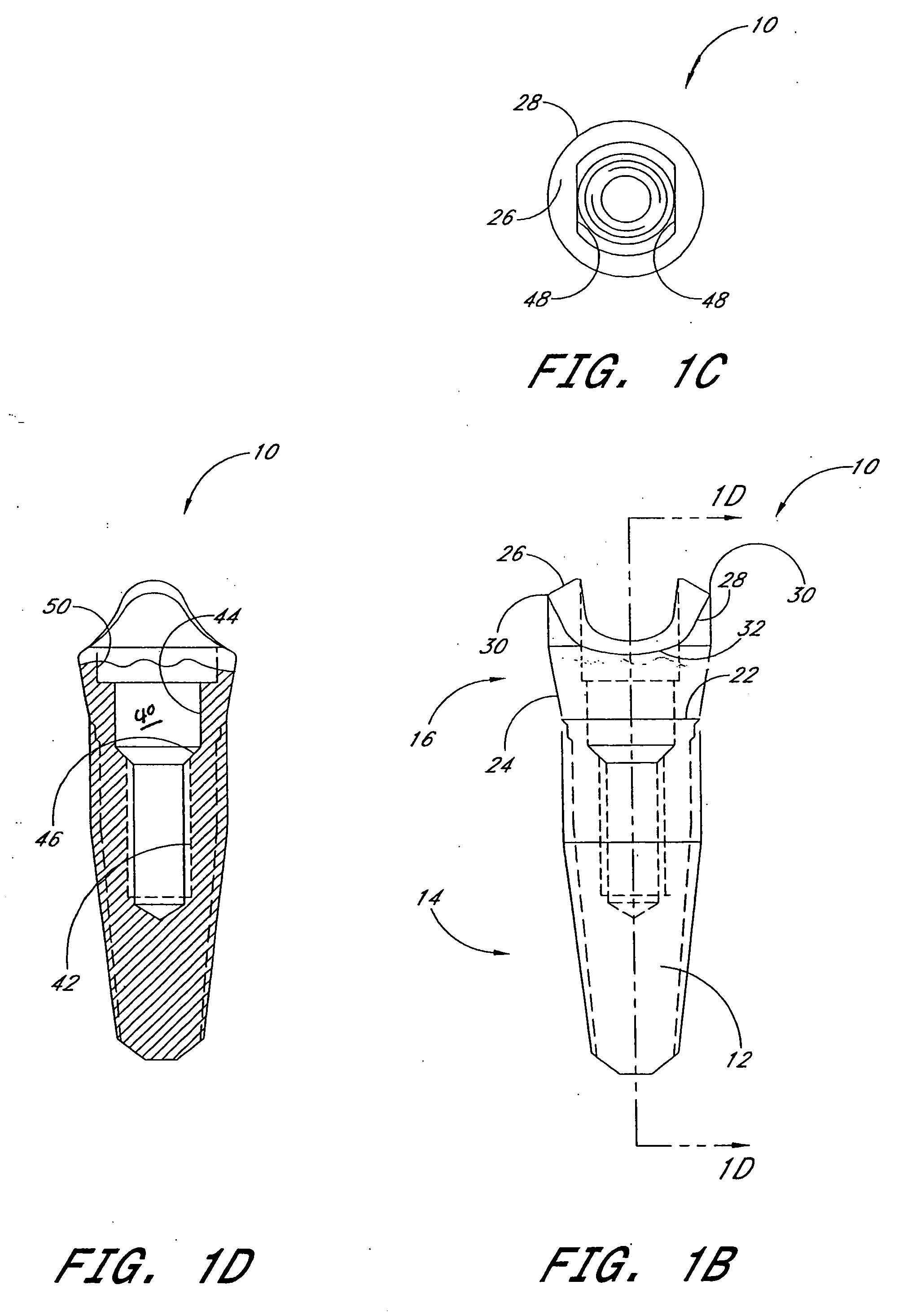 Dental implant system