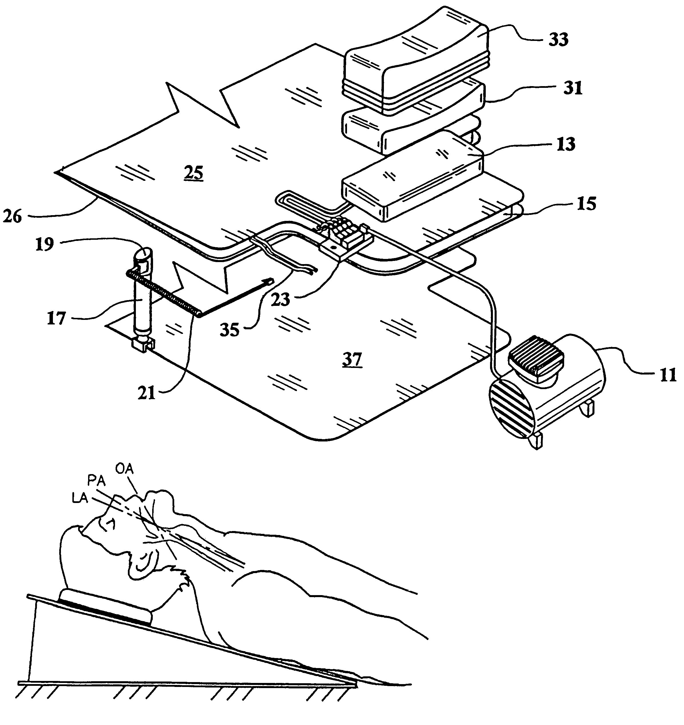 Active head/neck positioning device for endotracheal intubation