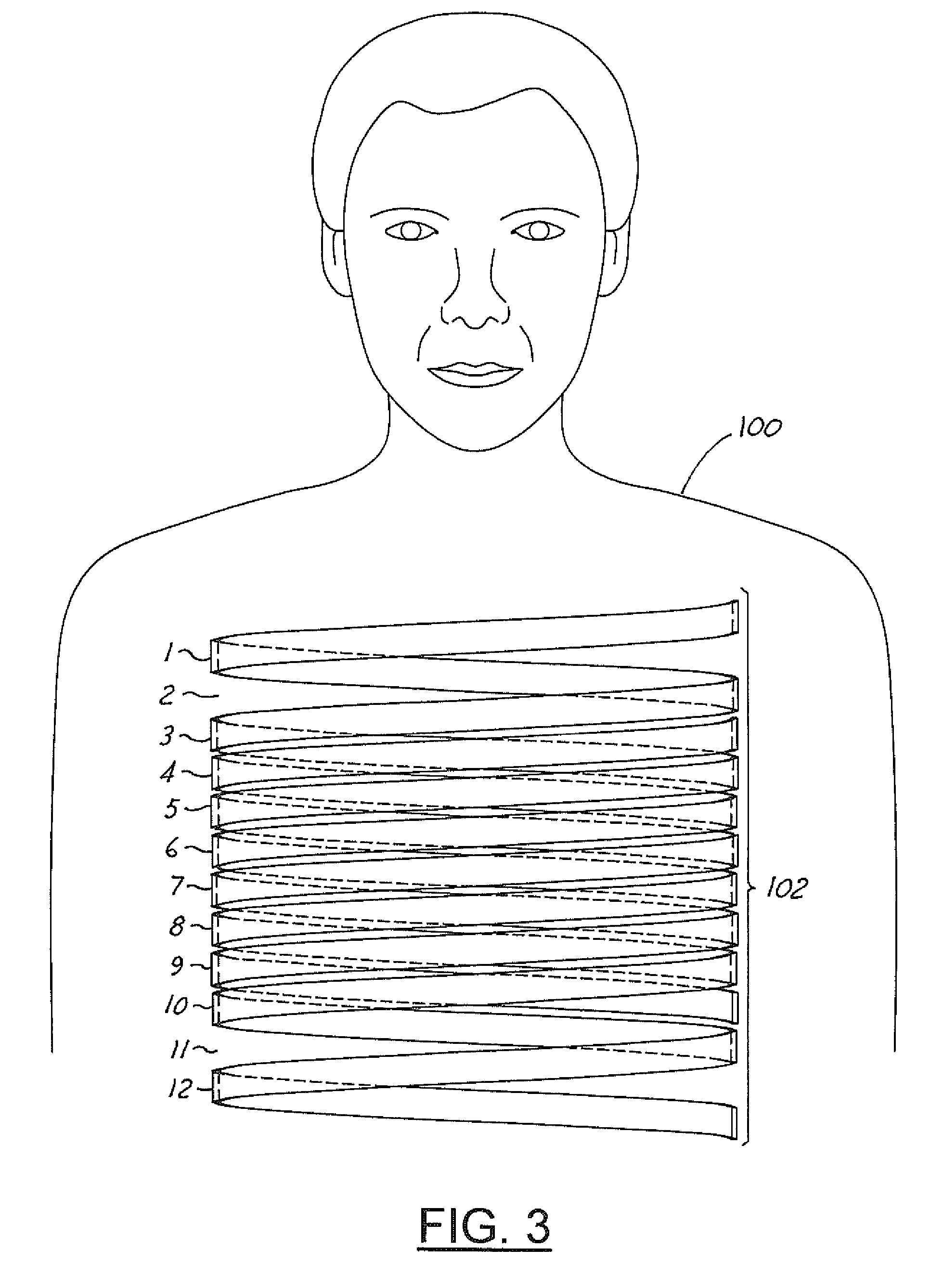 Method and apparatus for x-ray anode with increased coverage