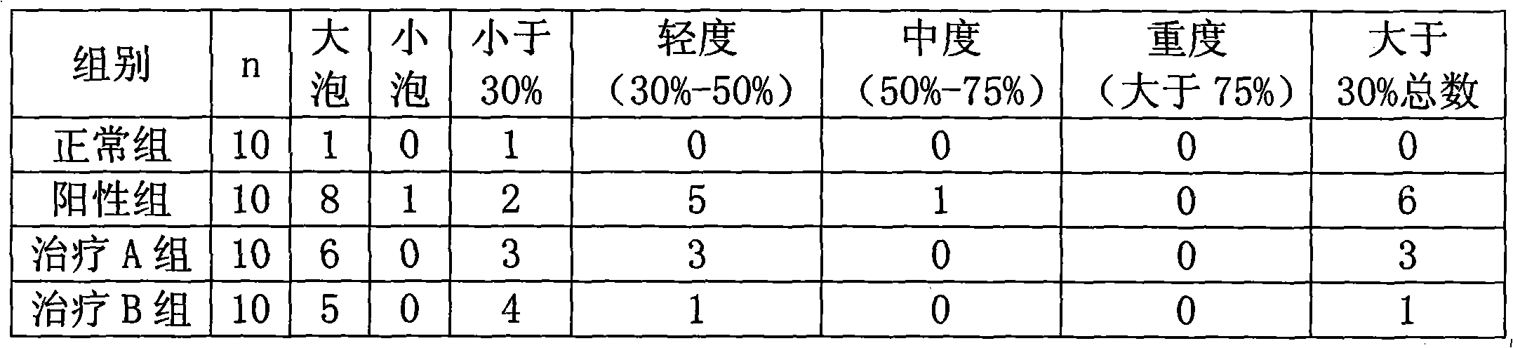 Ursodeoxycholic acid phospholipid composition and preparation method thereof