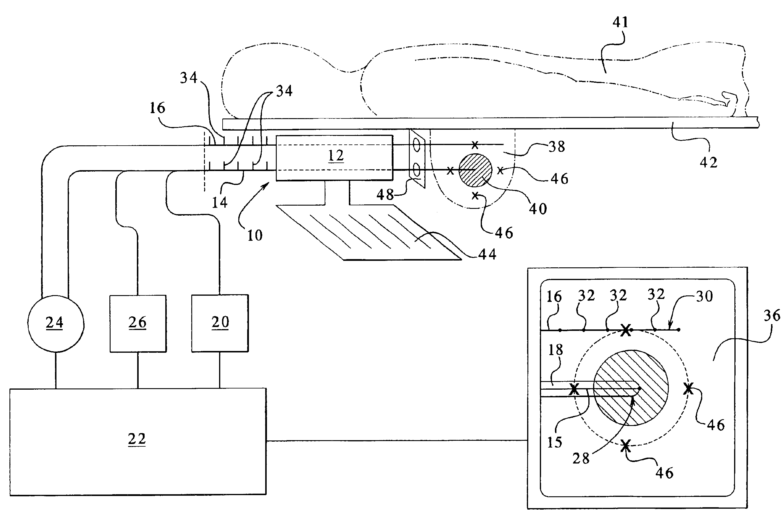 Apparatus and method for delivering ablative laser energy and determining the volume of tumor mass destroyed