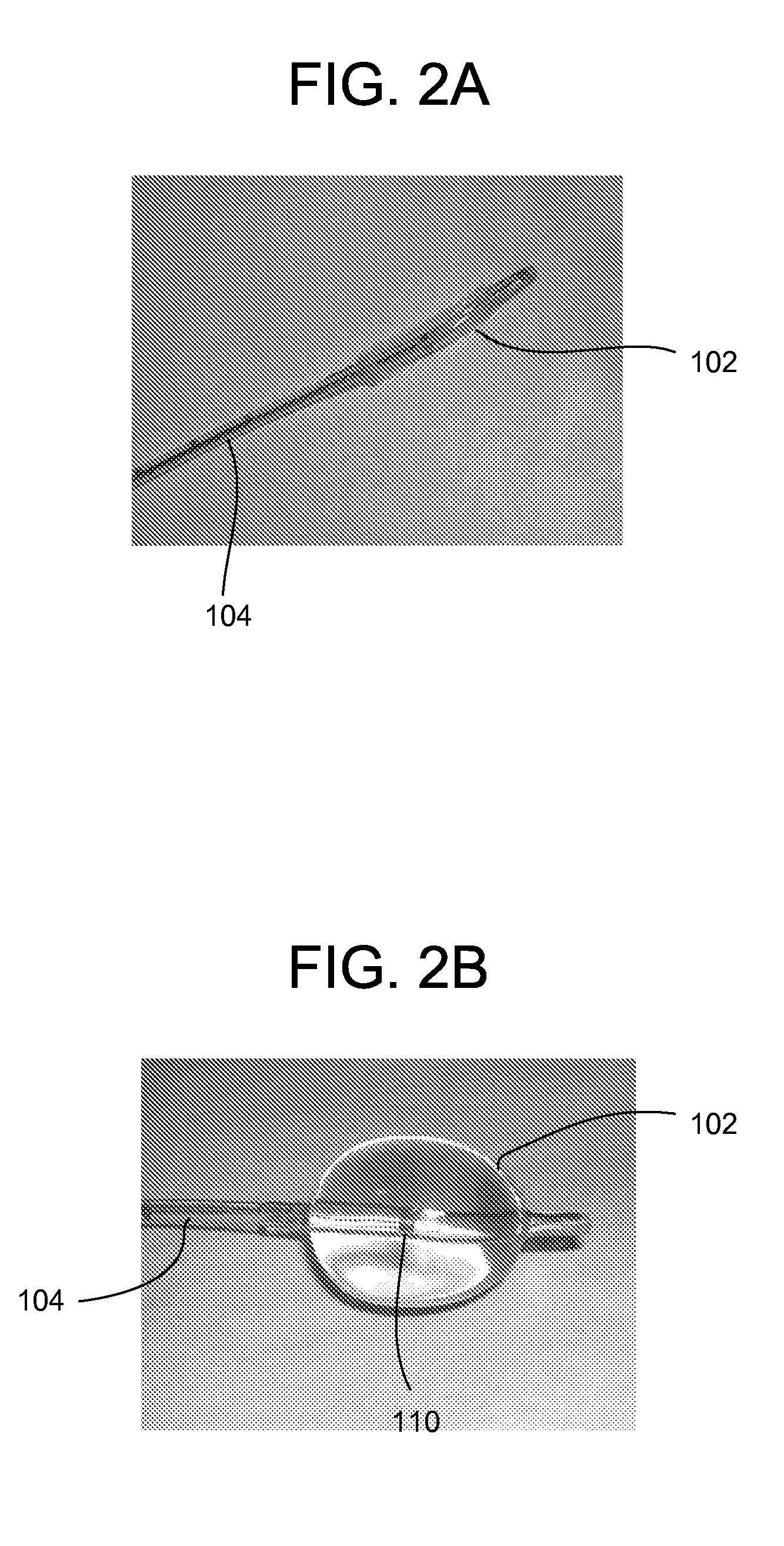 Methods and apparatus for electrical stimulation treatment using esophageal balloon and electrode