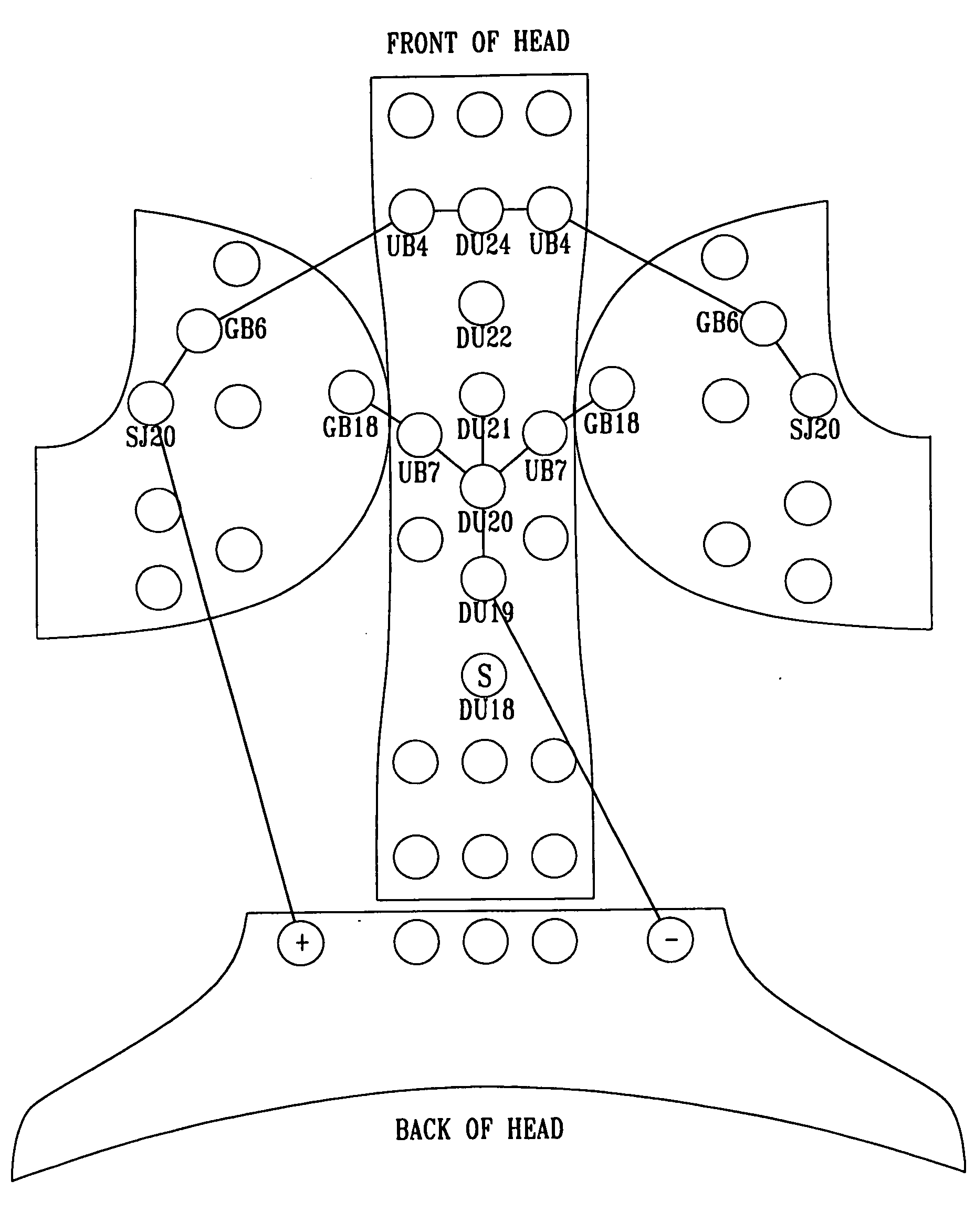 Method for moderation of sleep disorder