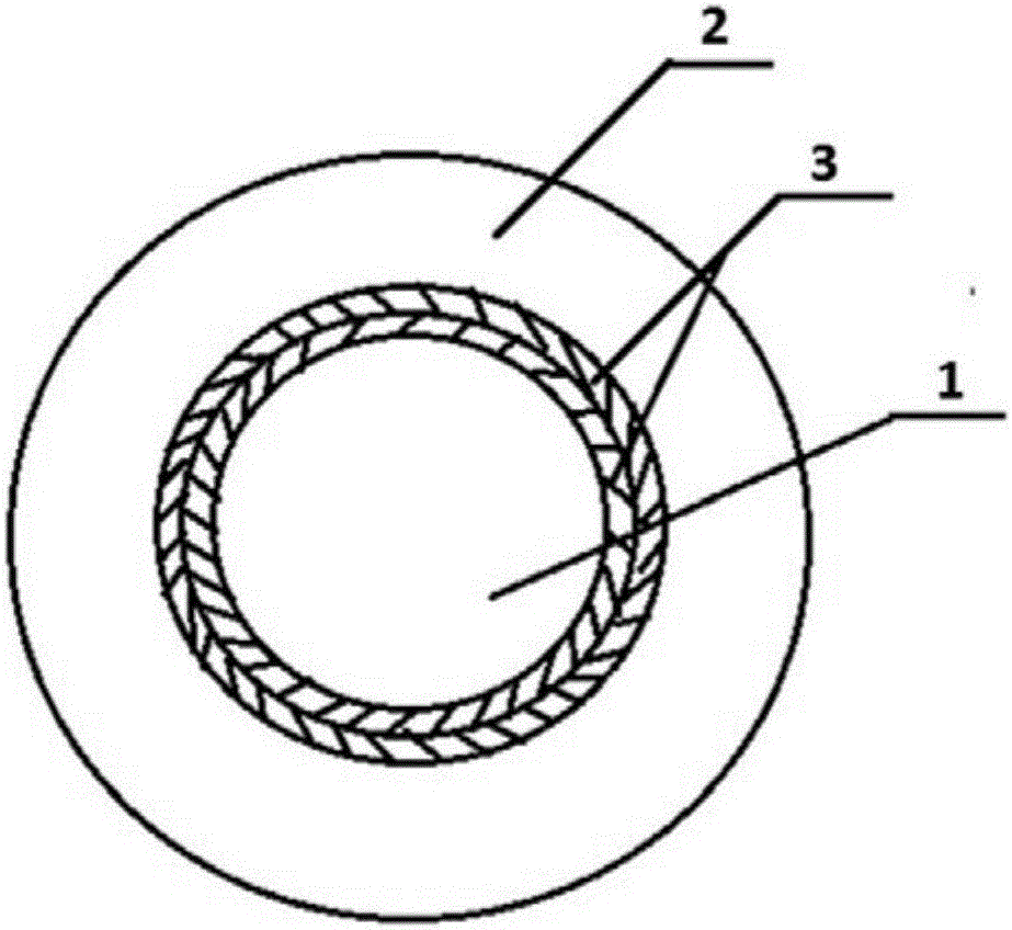 Keratoprosthesis