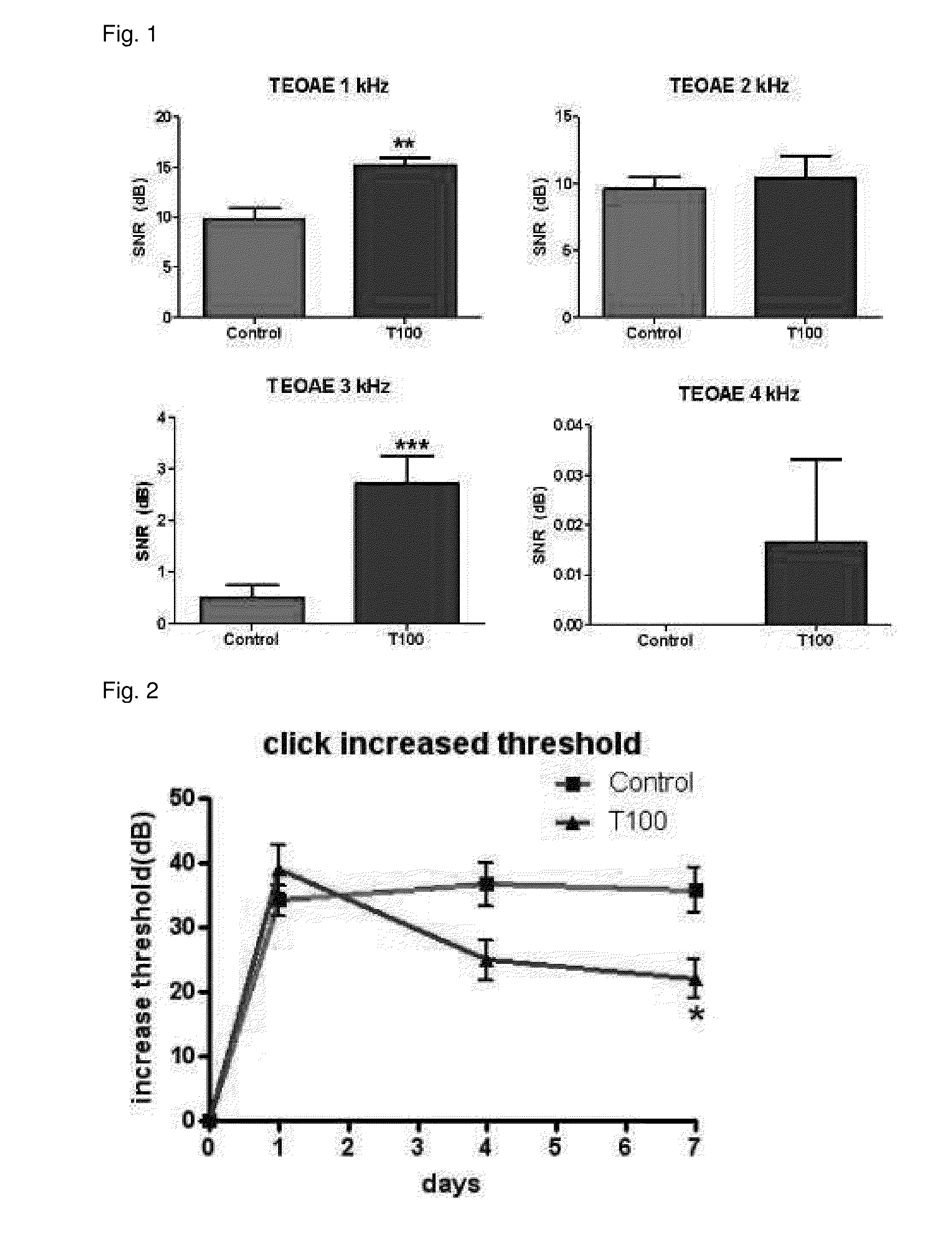 Composition for preventing or treating hearing loss