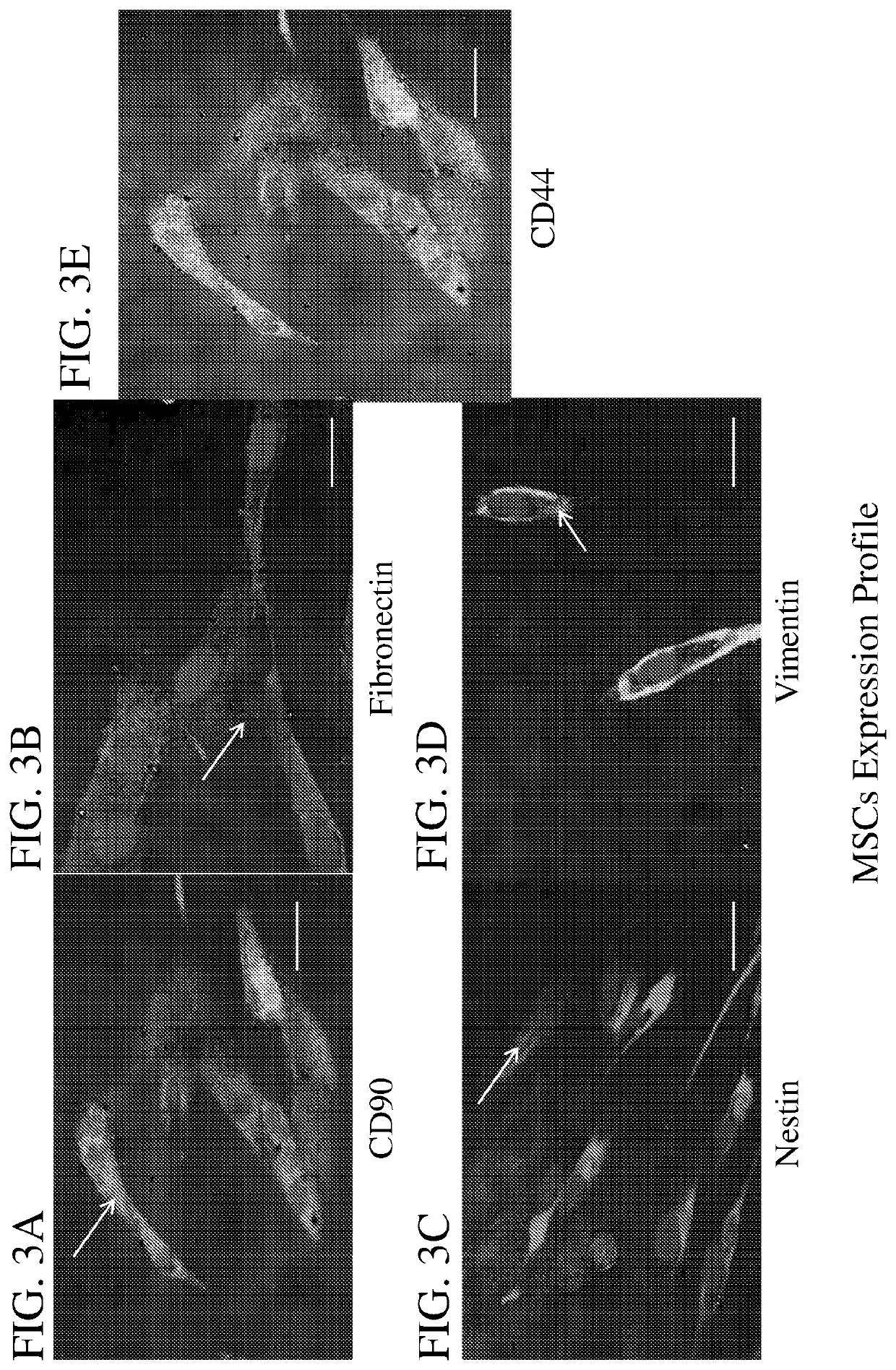 Immature dental pulp stem cells and methods of use to treat bone marrow failure