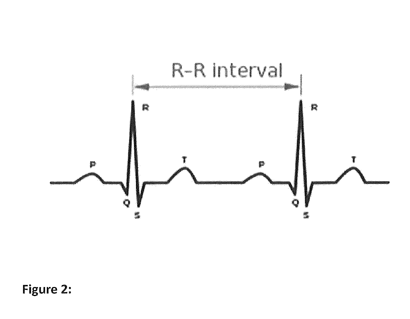 Method for confidence level determination of ambulatory hr algorithm based on a three-way rhythm classifier