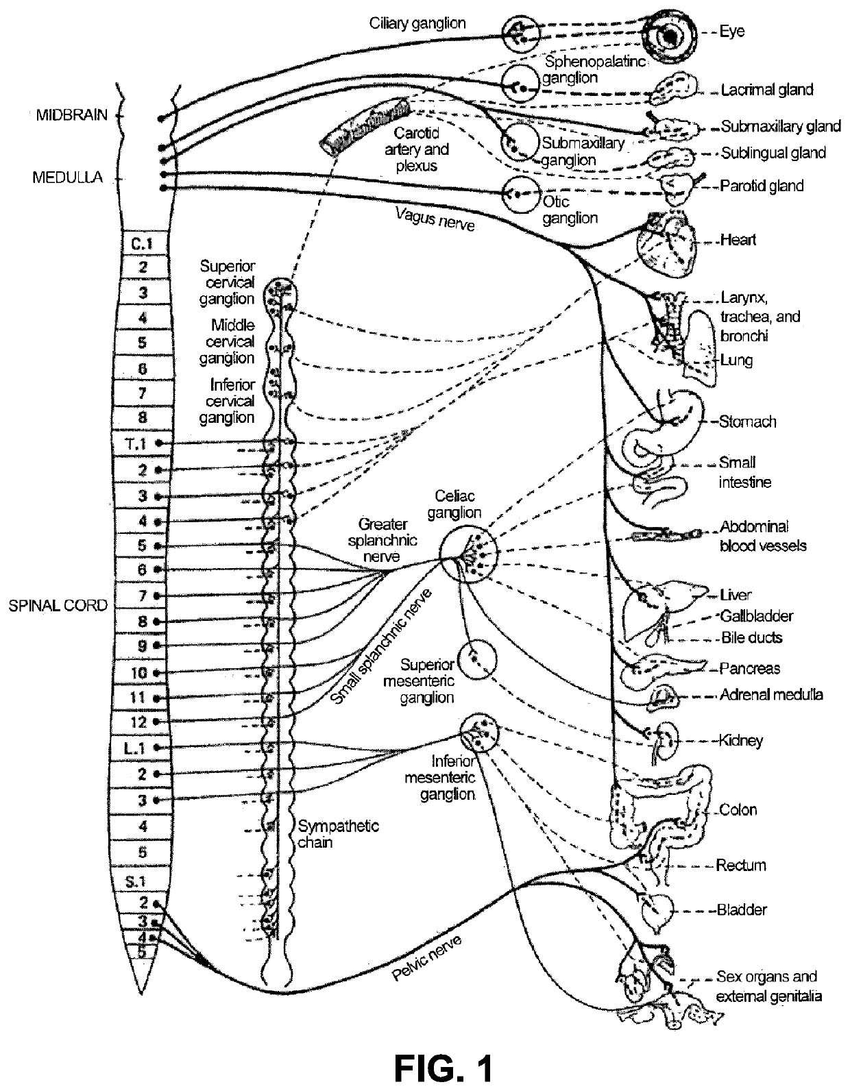 Apparatus to treat cardiopulmonary disease