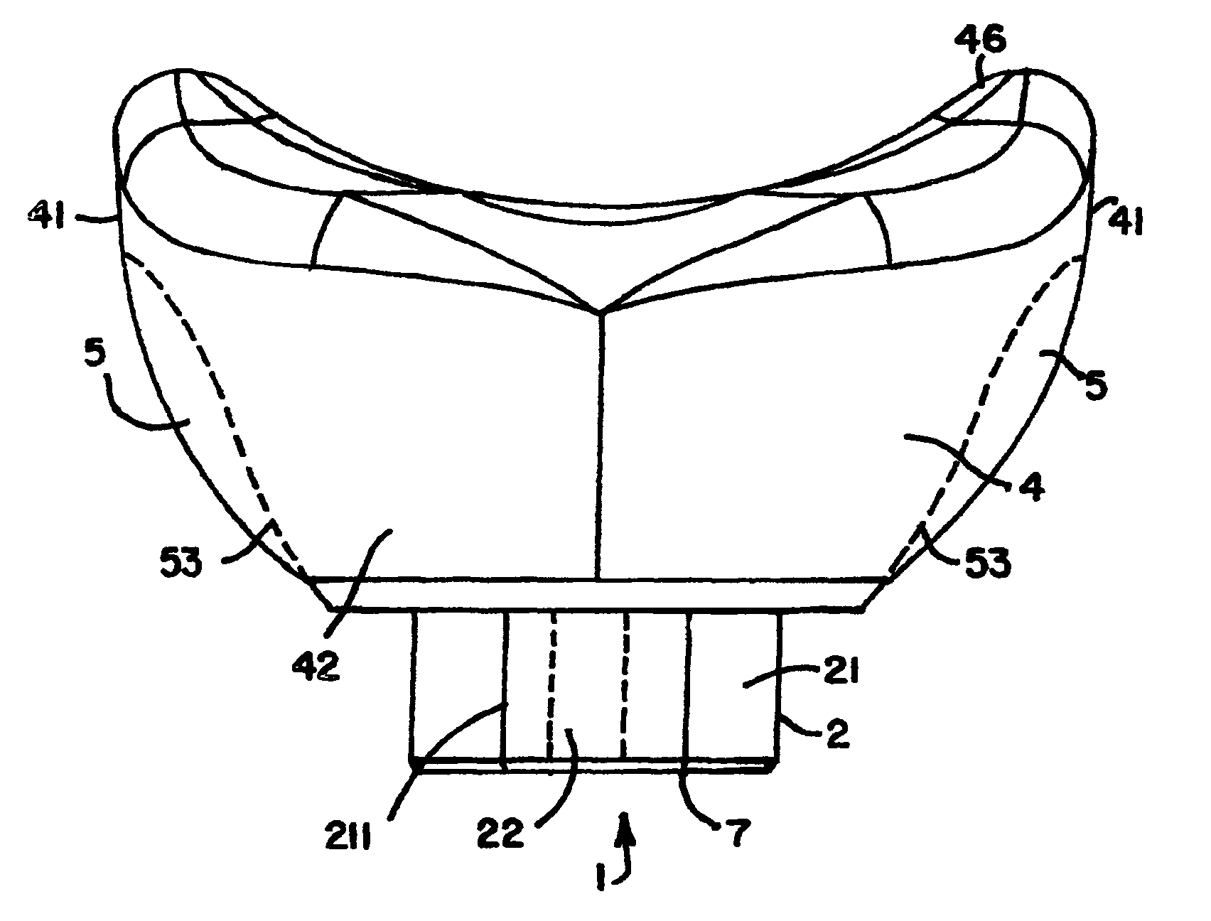 Healing abutment system for bone contouring