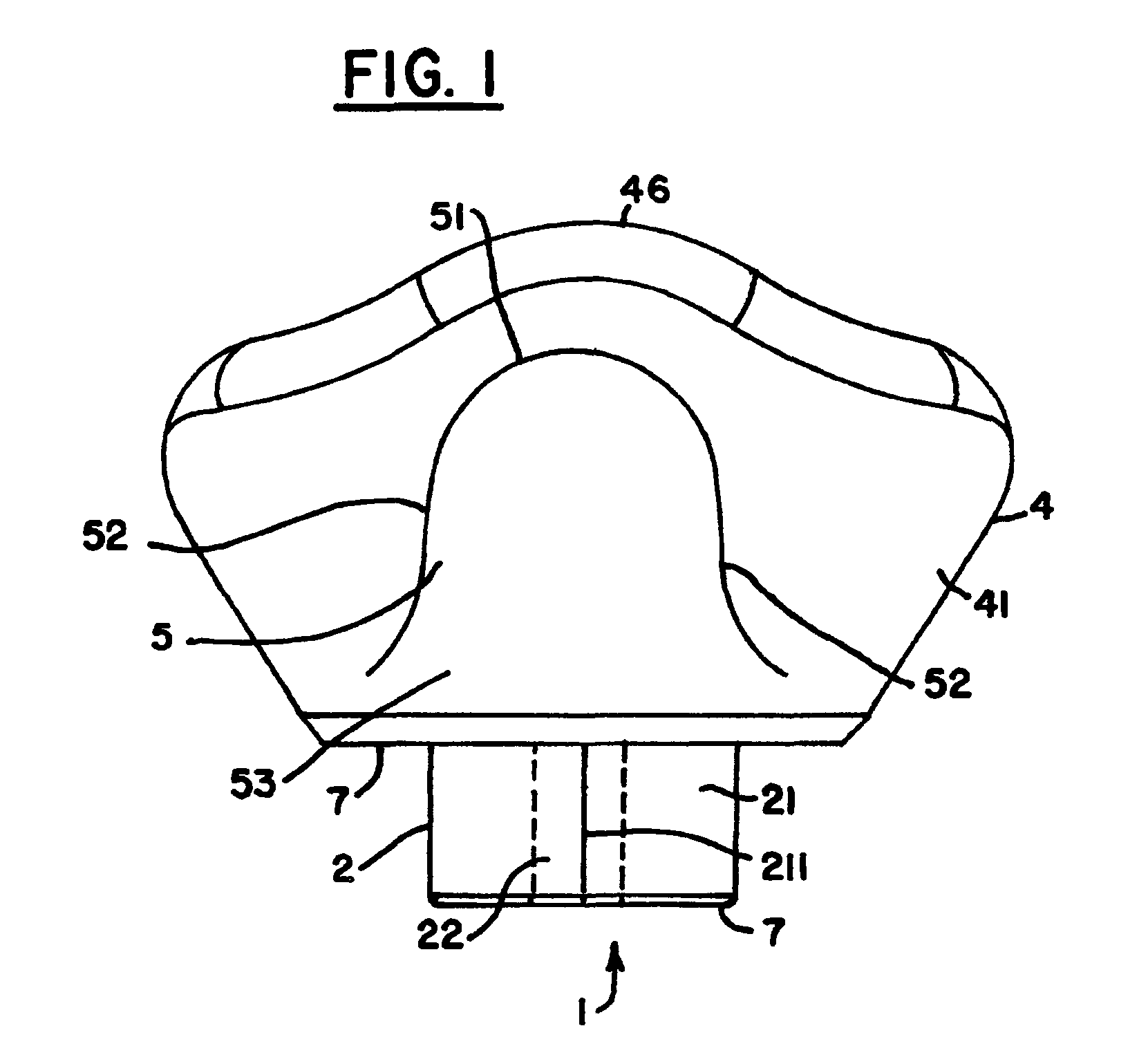 Healing abutment system for bone contouring