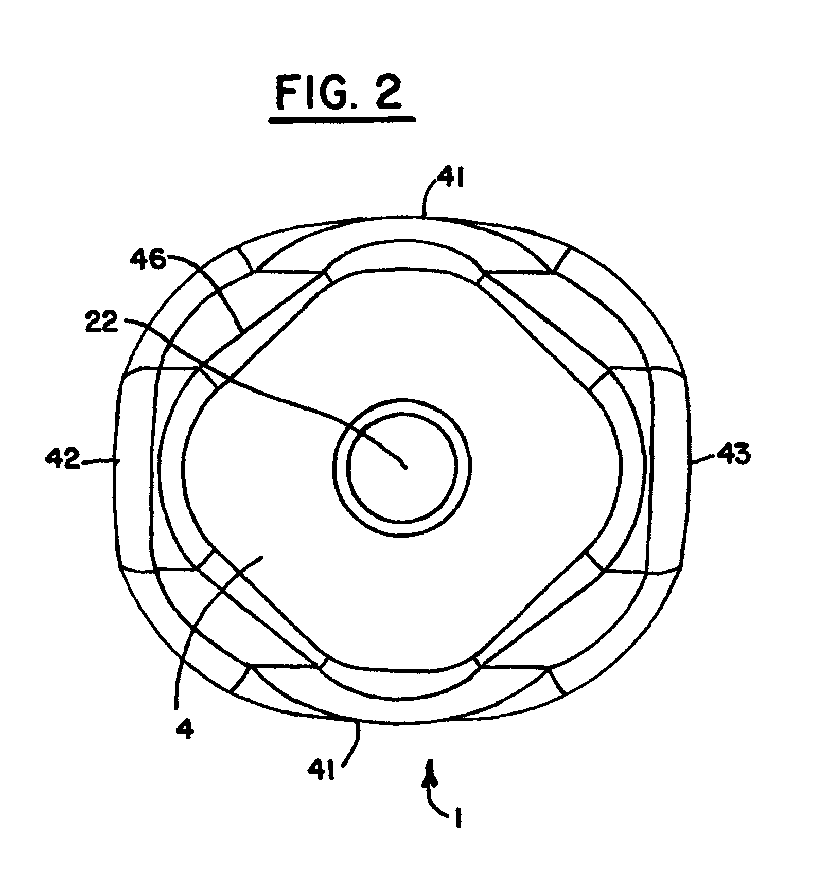 Healing abutment system for bone contouring