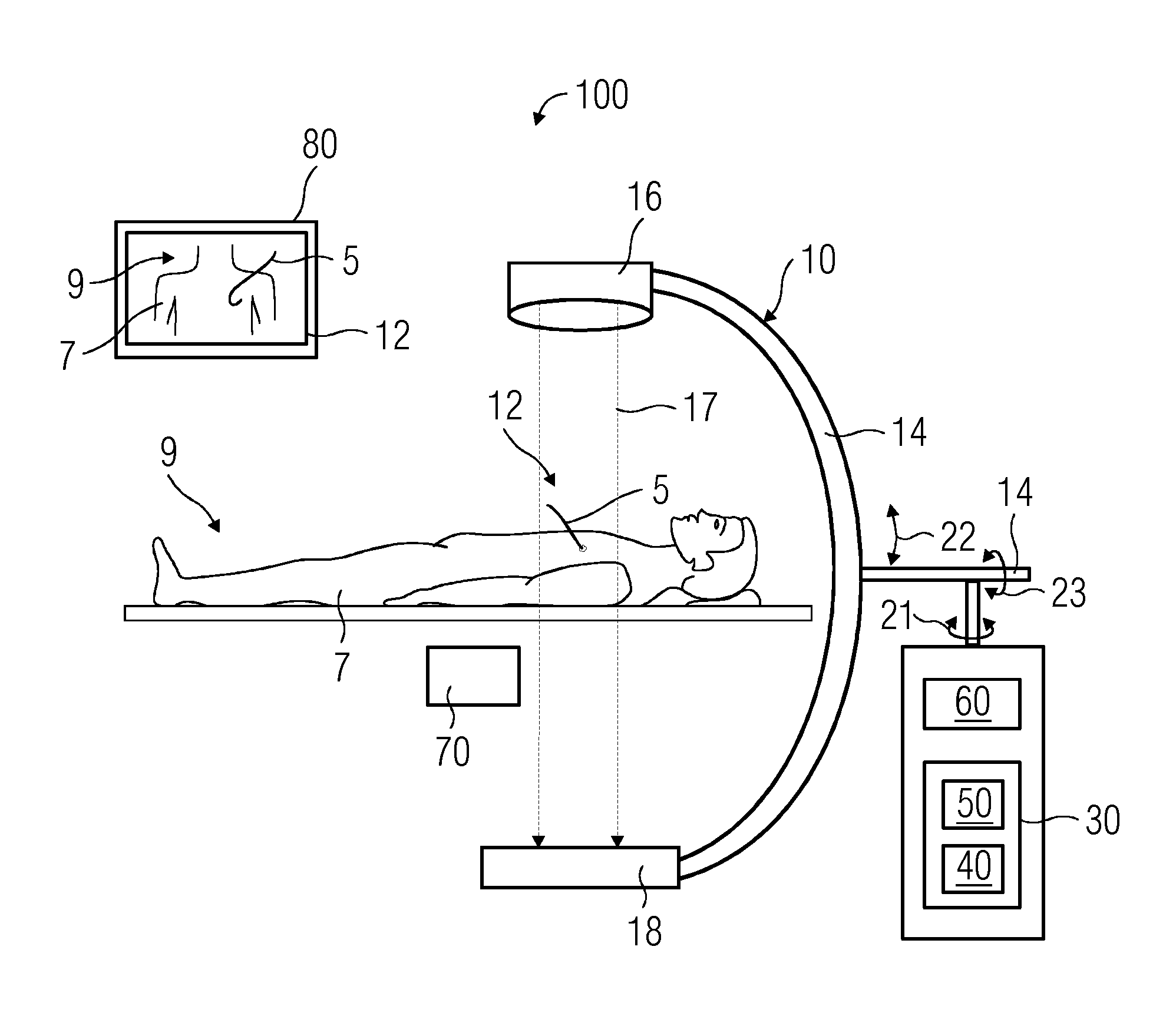 Assisting Navigation of a Medical Insert Inside a Patient