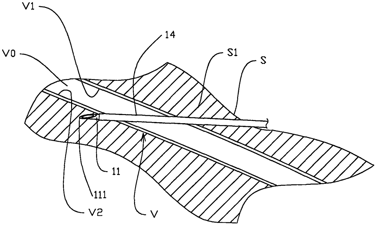 Safe-type venous indwelling needle