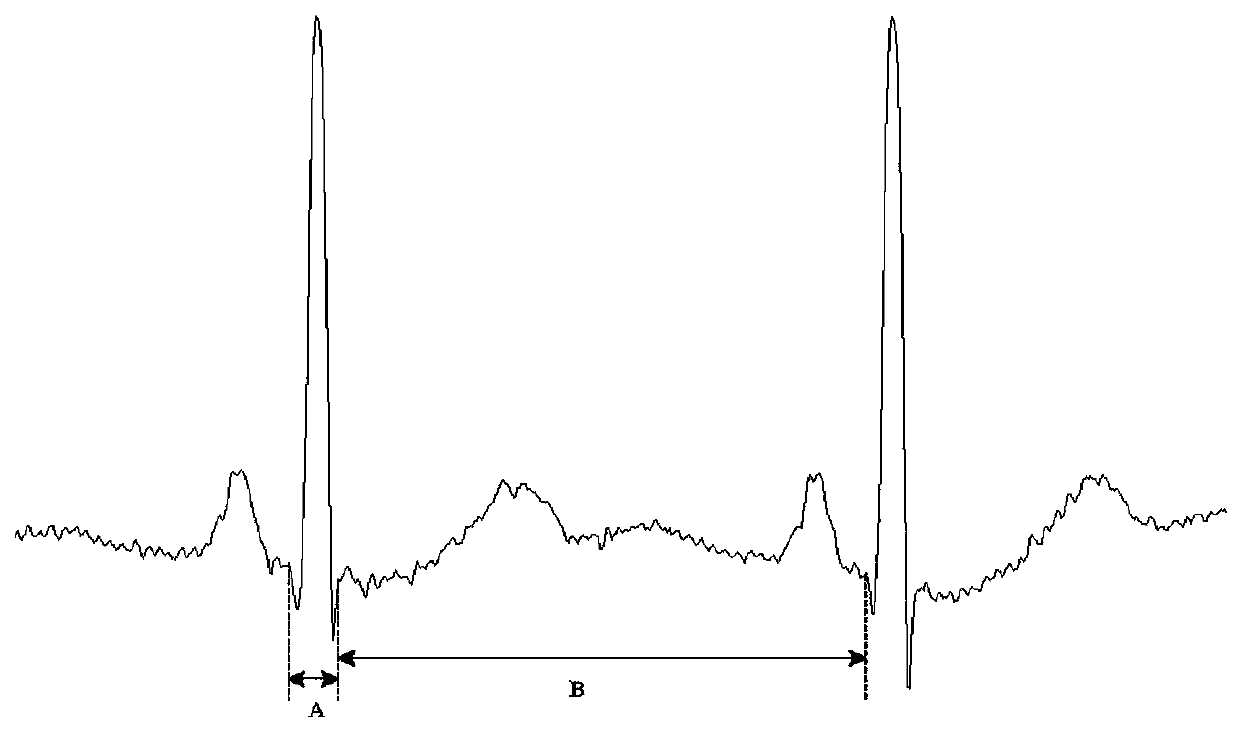 Electrocardiogram analysis system and study updating method of data analysis algorithm of electrocardiogram analysis system