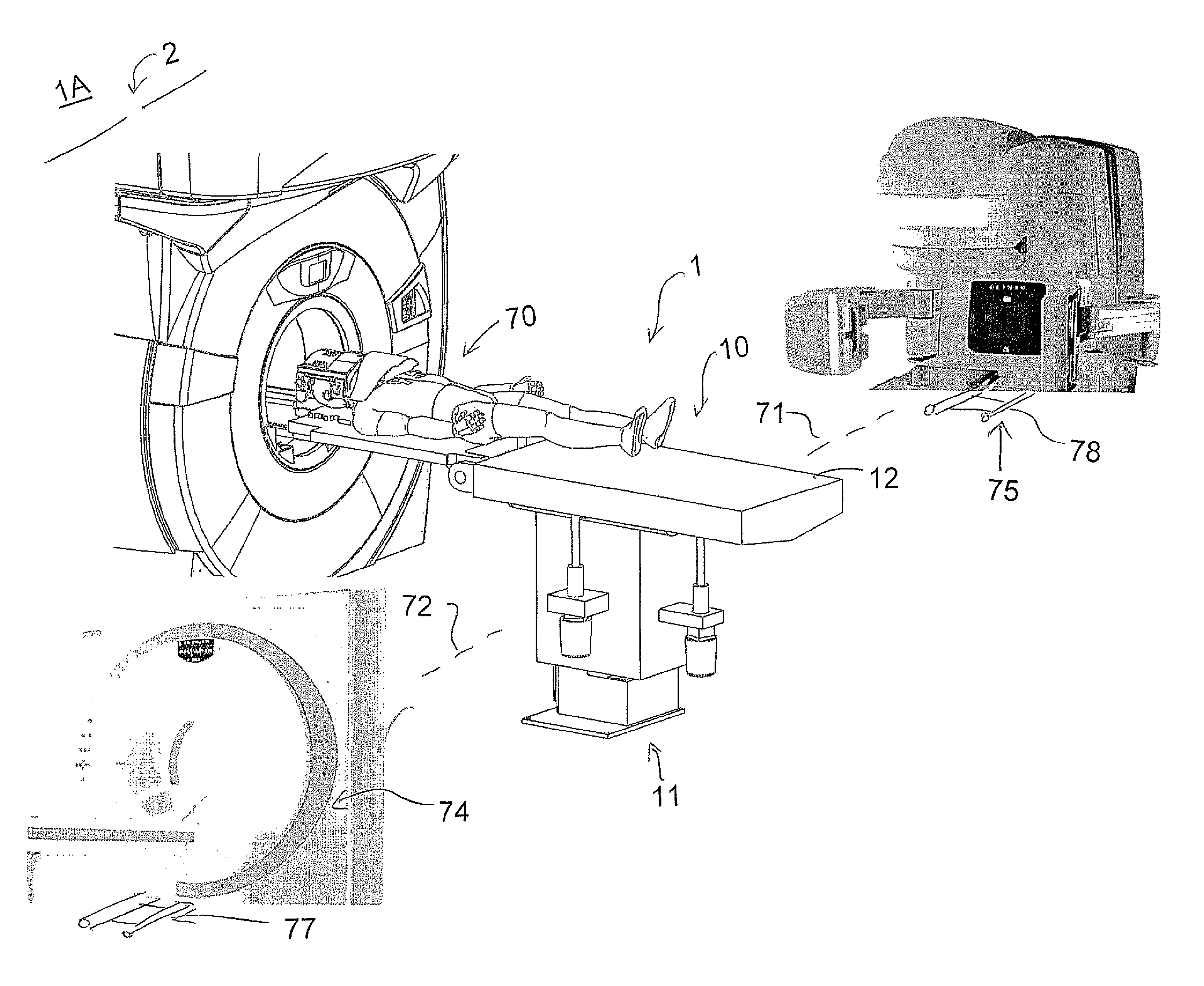 Image guided radiation therapy