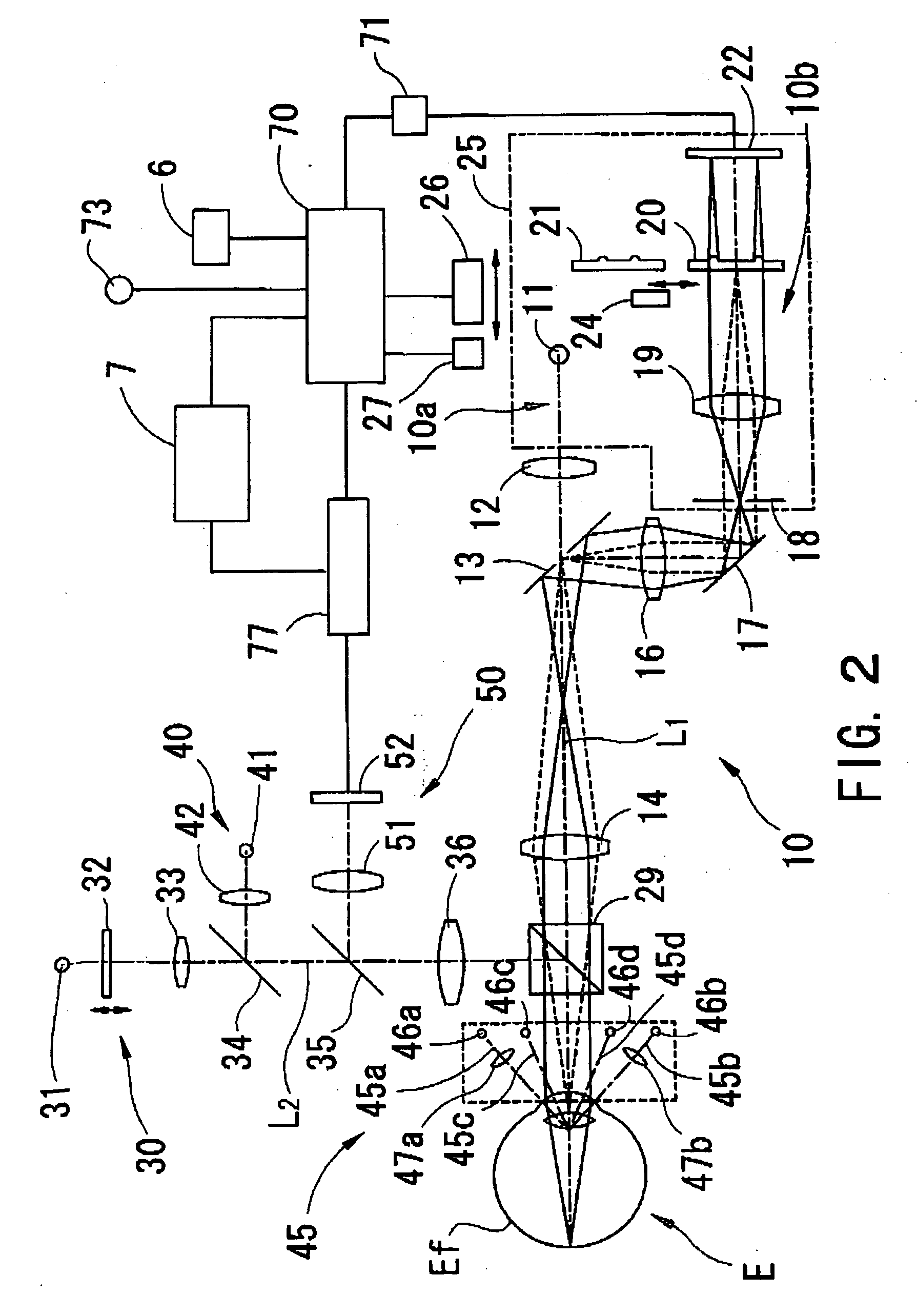 Eye refractive power measurement apparatus