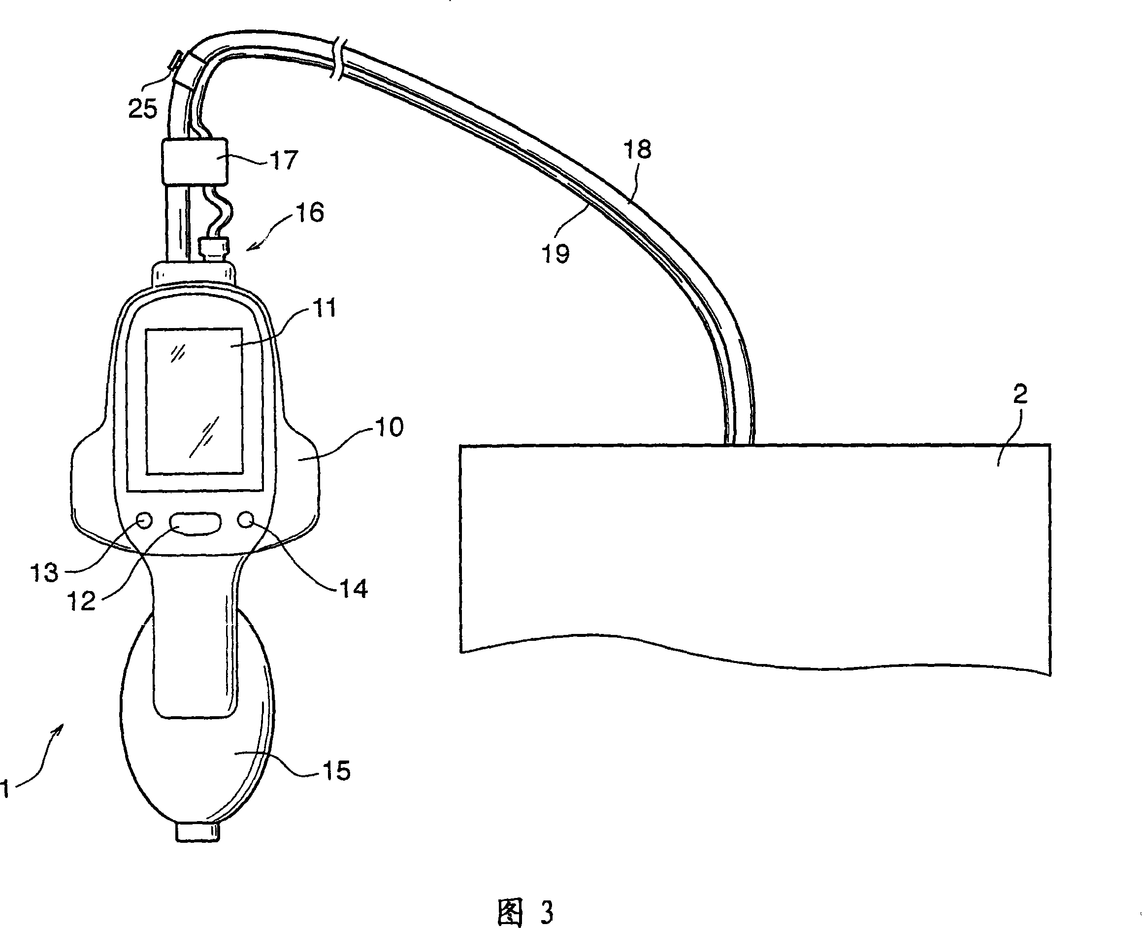 Sphygmomanometer