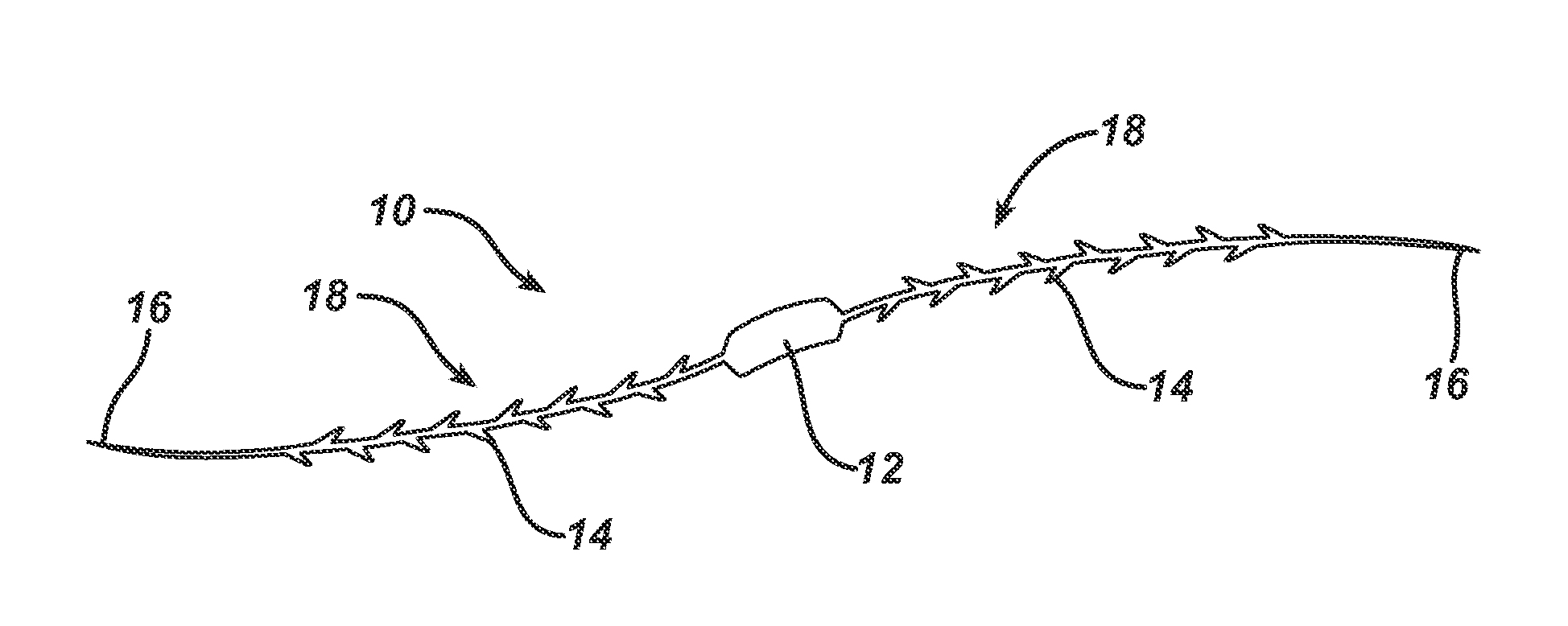 Systems and methods to treat upper pharyngeal airway of obstructive sleep apnea patients