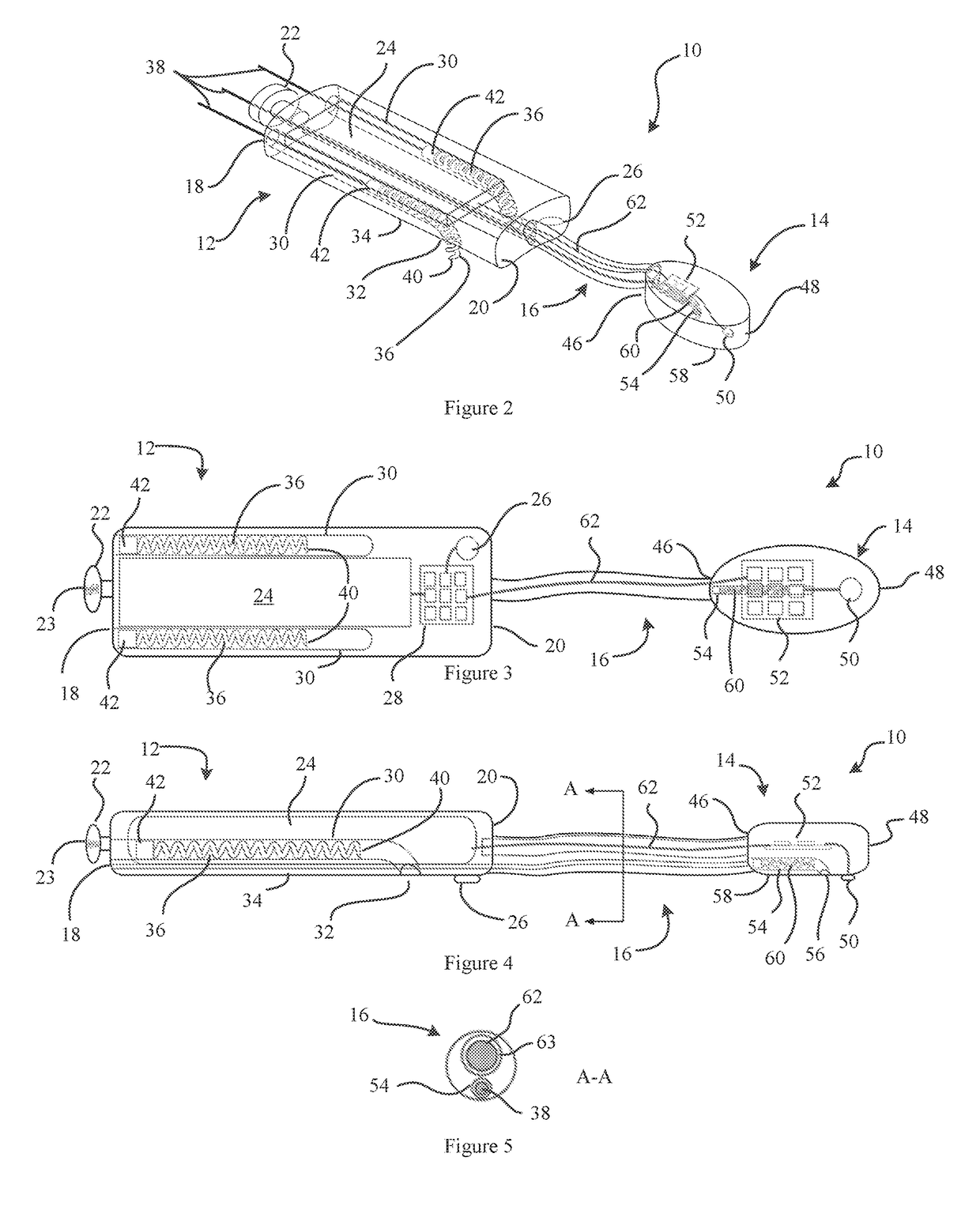 Epicardial heart rhythm management devices, systems and methods