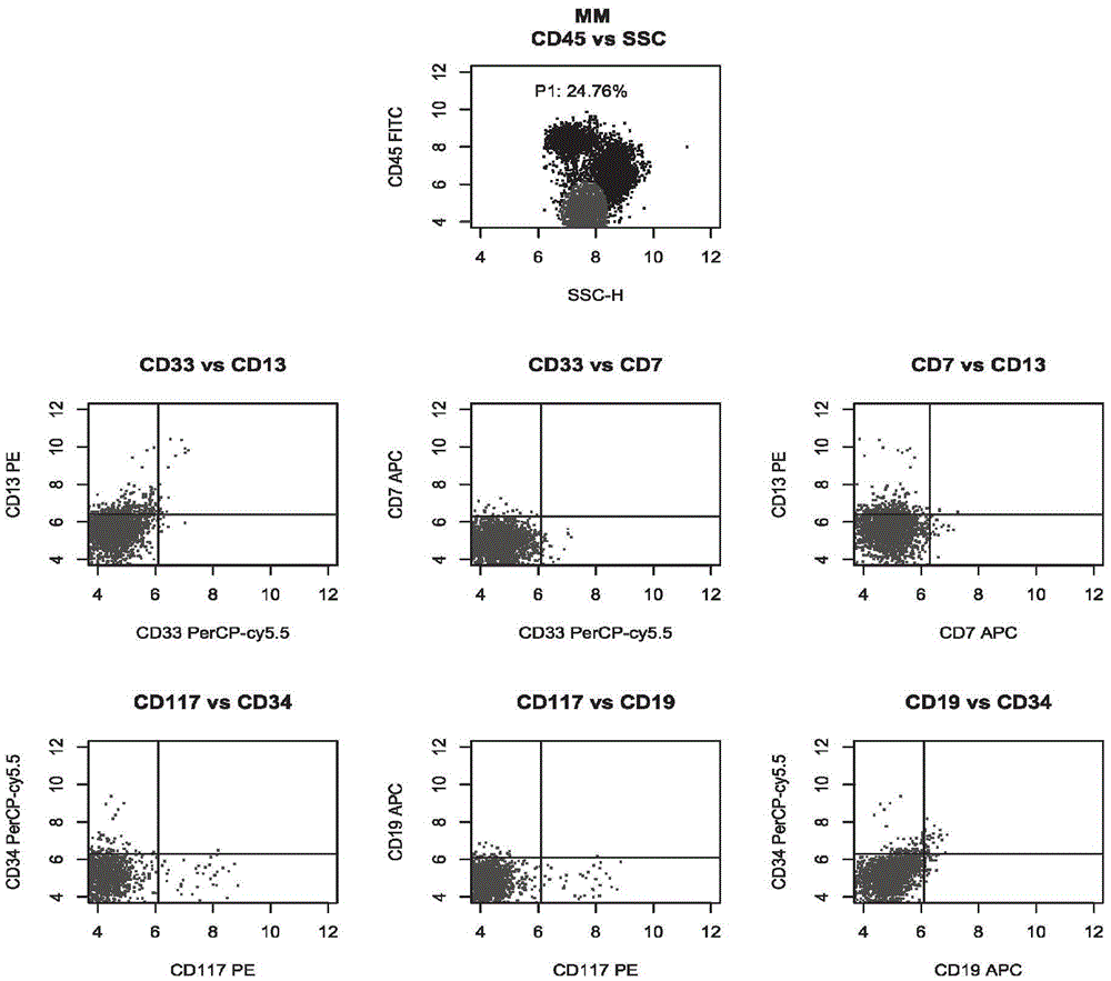 Antibody composition and application of antibody composition in leukemia and lymphoma typing