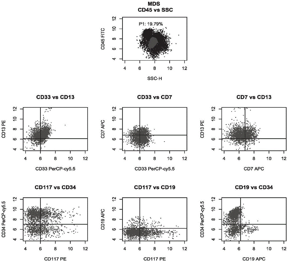 Antibody composition and application of antibody composition in leukemia and lymphoma typing