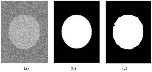 Multi-threshold ultrasonic image segmentation method based on differential search algorithm