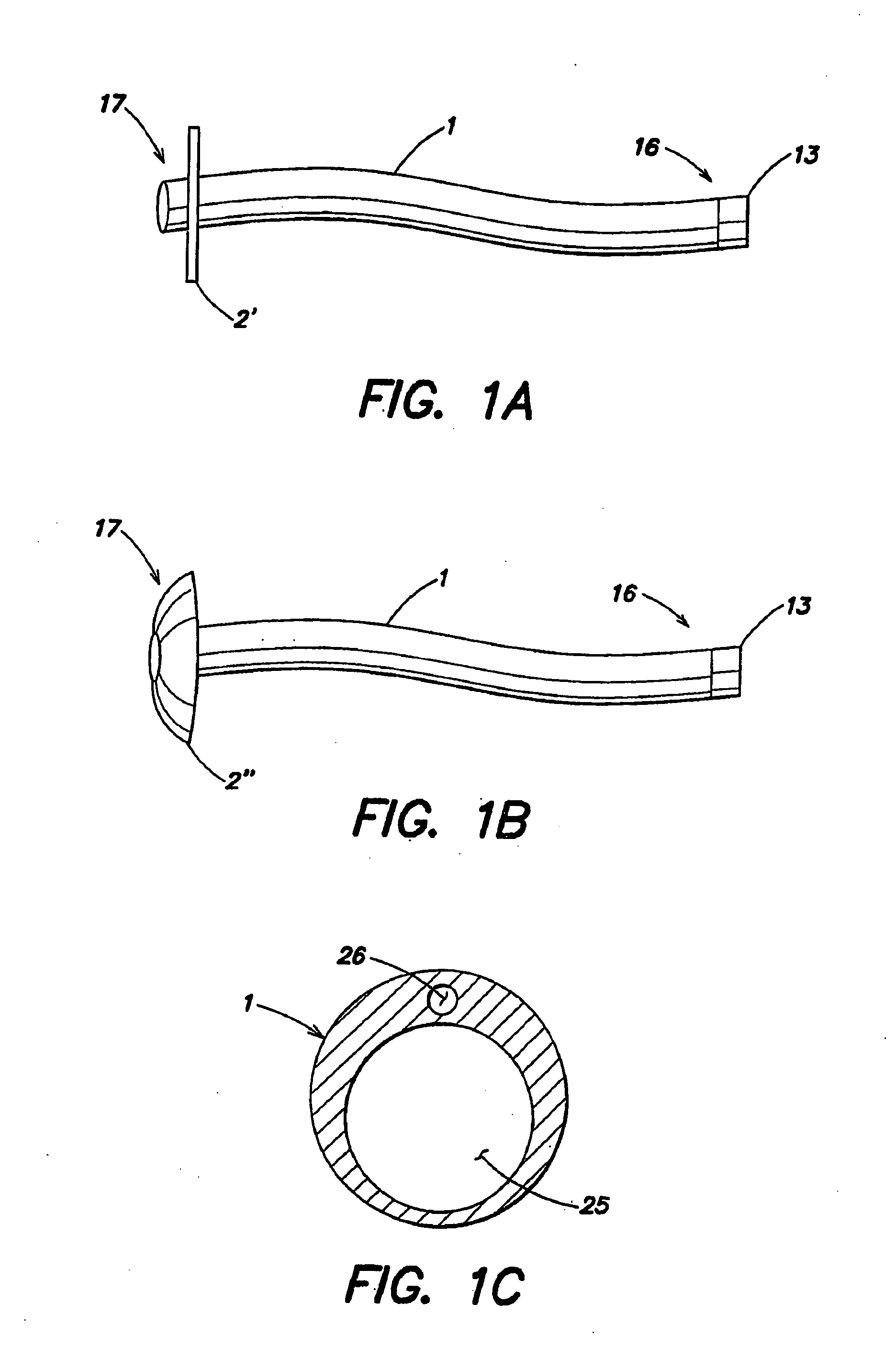 Method for treating obesity by extracting food