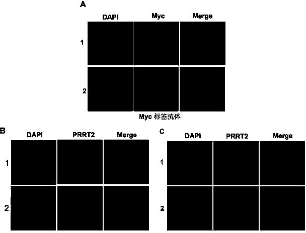 Mouse anti-human PRRT2 monoclonal antibody, and preparation method and application thereof