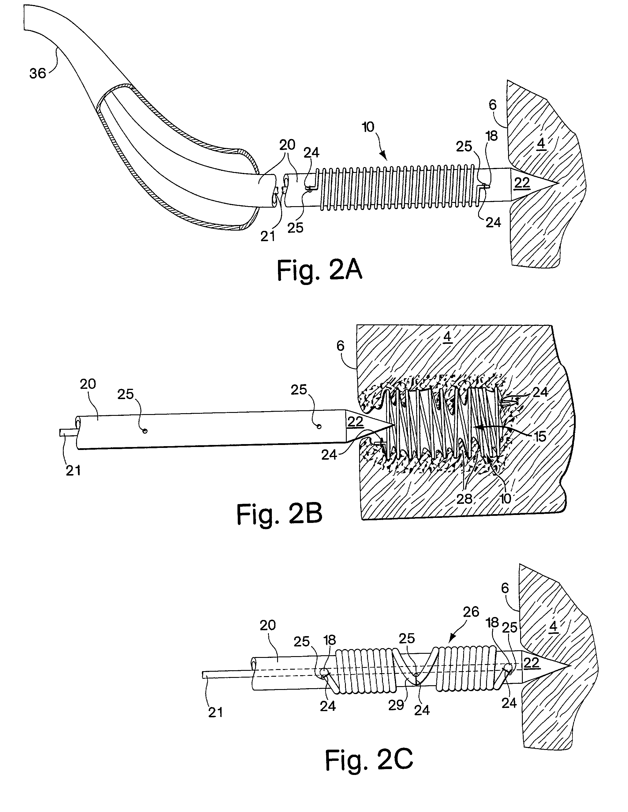 Vascular inducing implants