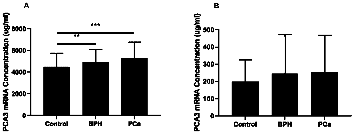 Kit for detecting prostate cancer and preparation method of kit