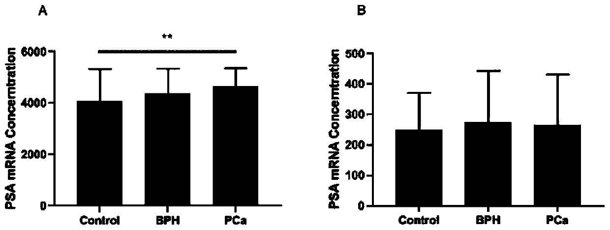 Kit for detecting prostate cancer and preparation method of kit