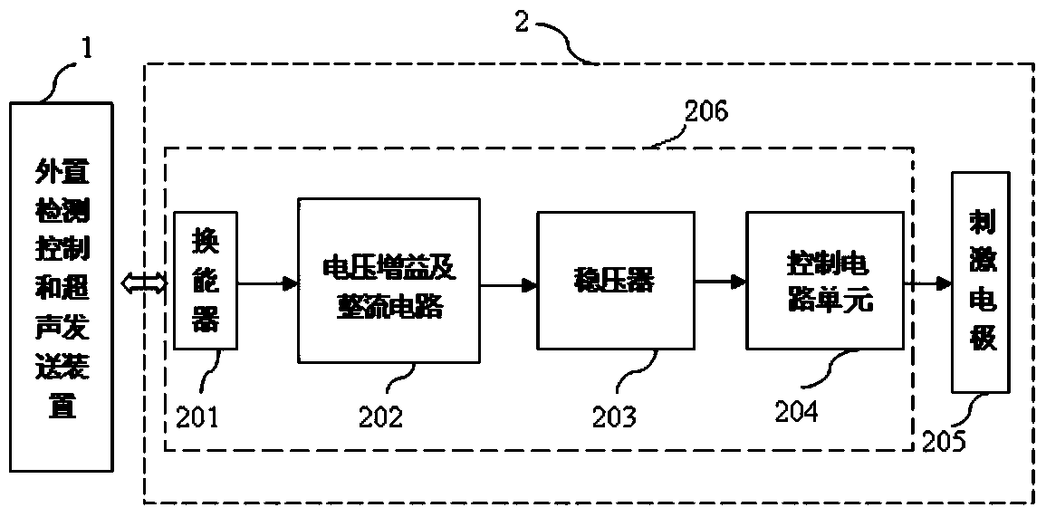 deep brain stimulation system