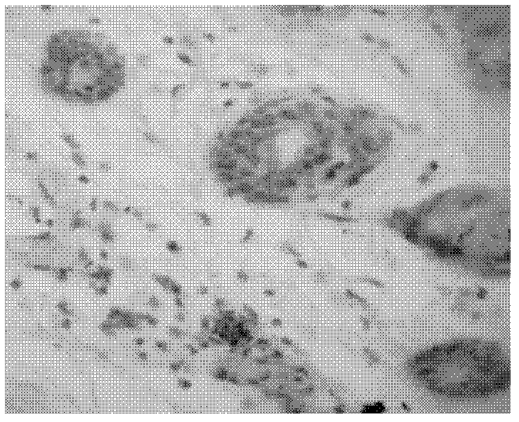 Preparation method of flavonoid medicine for treating frostbite