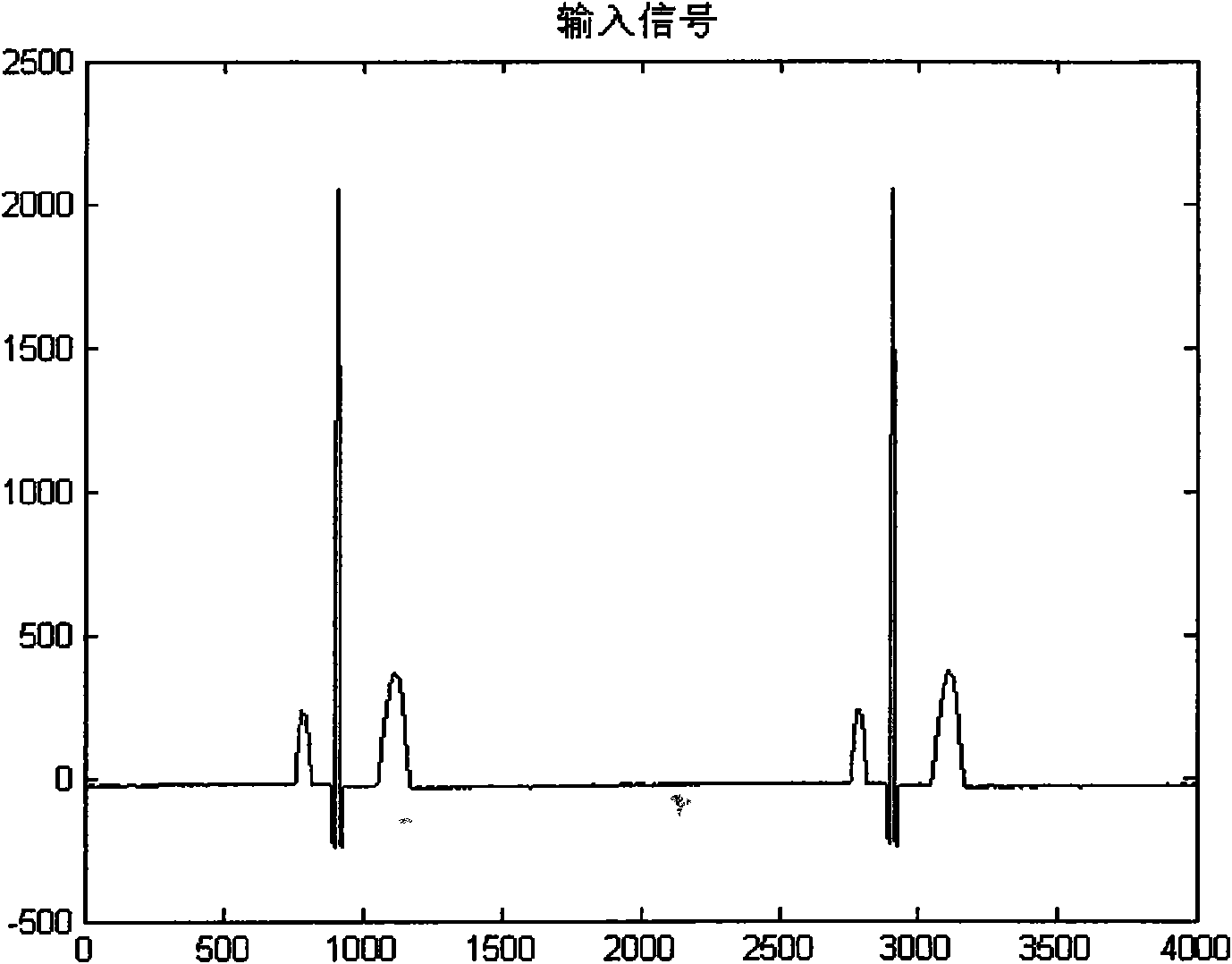 Power frequency interference filtering method for eliminating ringing