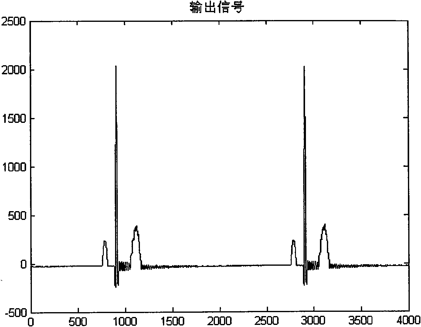 Power frequency interference filtering method for eliminating ringing