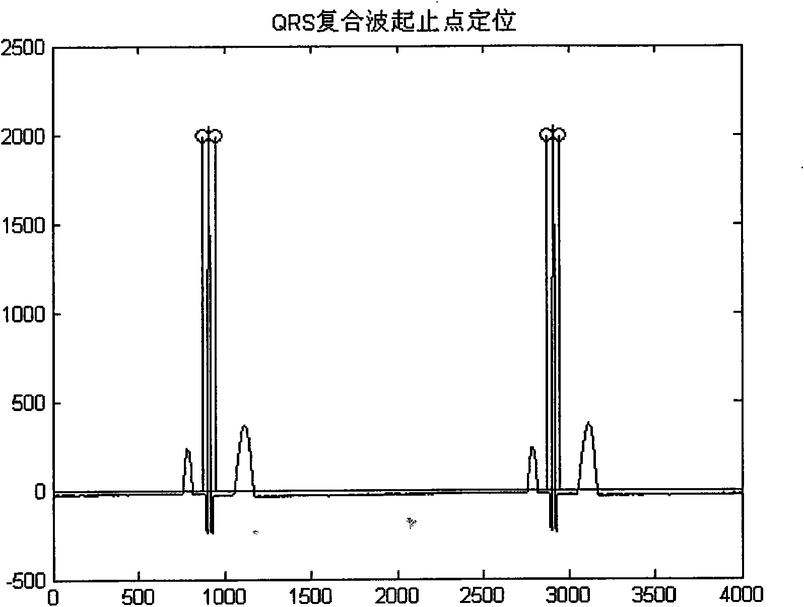 Power frequency interference filtering method for eliminating ringing