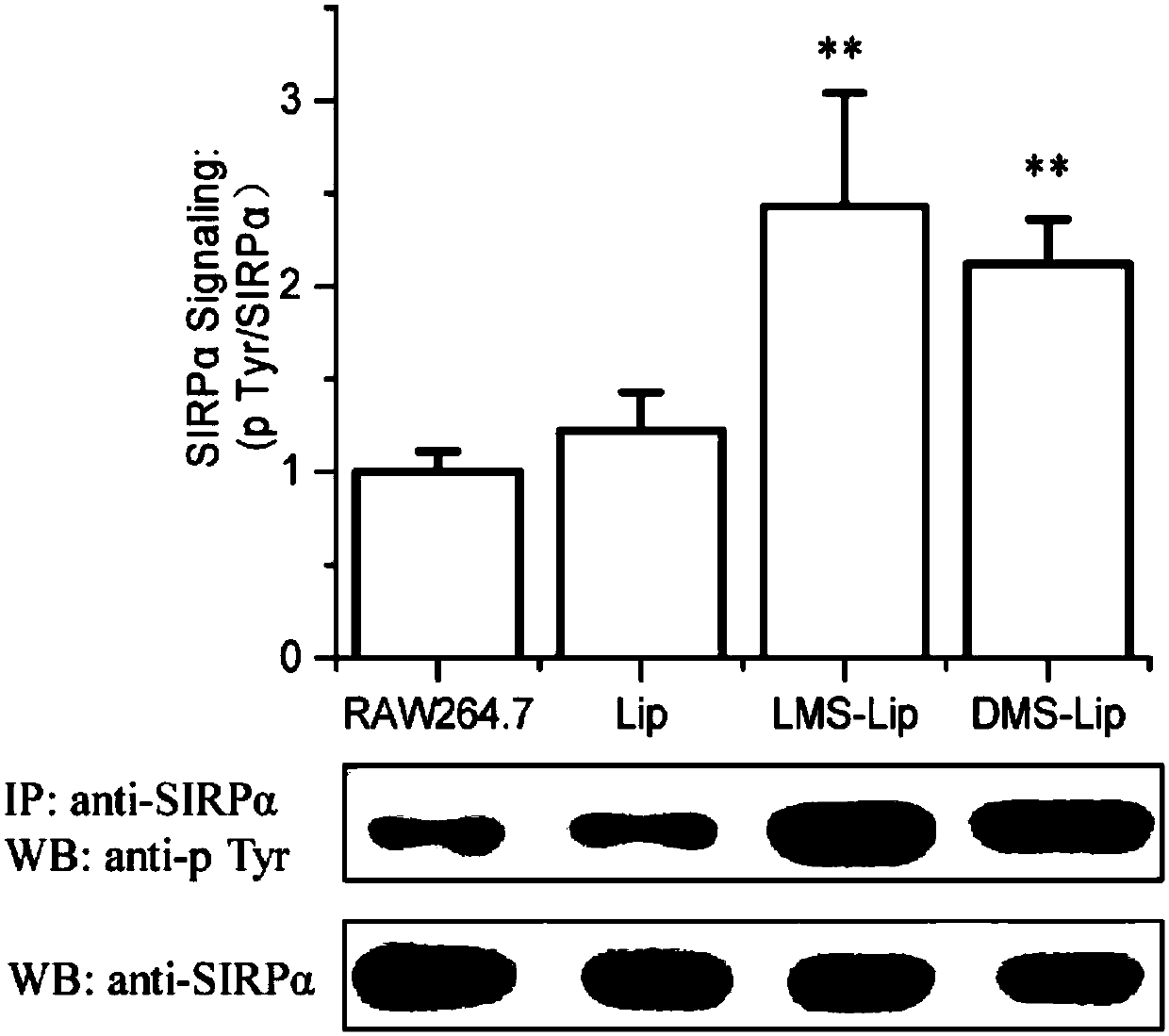 Polypeptide, polypeptide-modified lipid carrier and application of lipid carrier