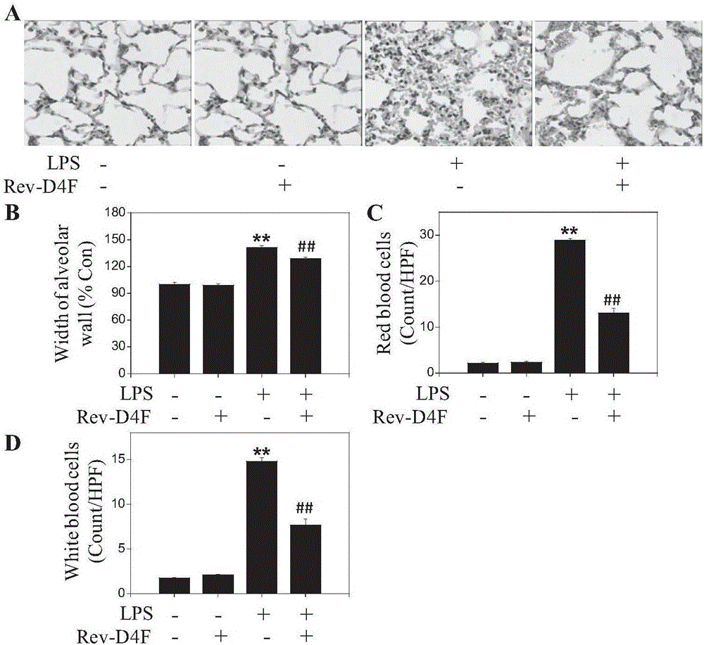 Application of high-density protein mimic peptide Reverse-D-4F in preparation of medicines for treating LPS-induced respiratory distress syndrome