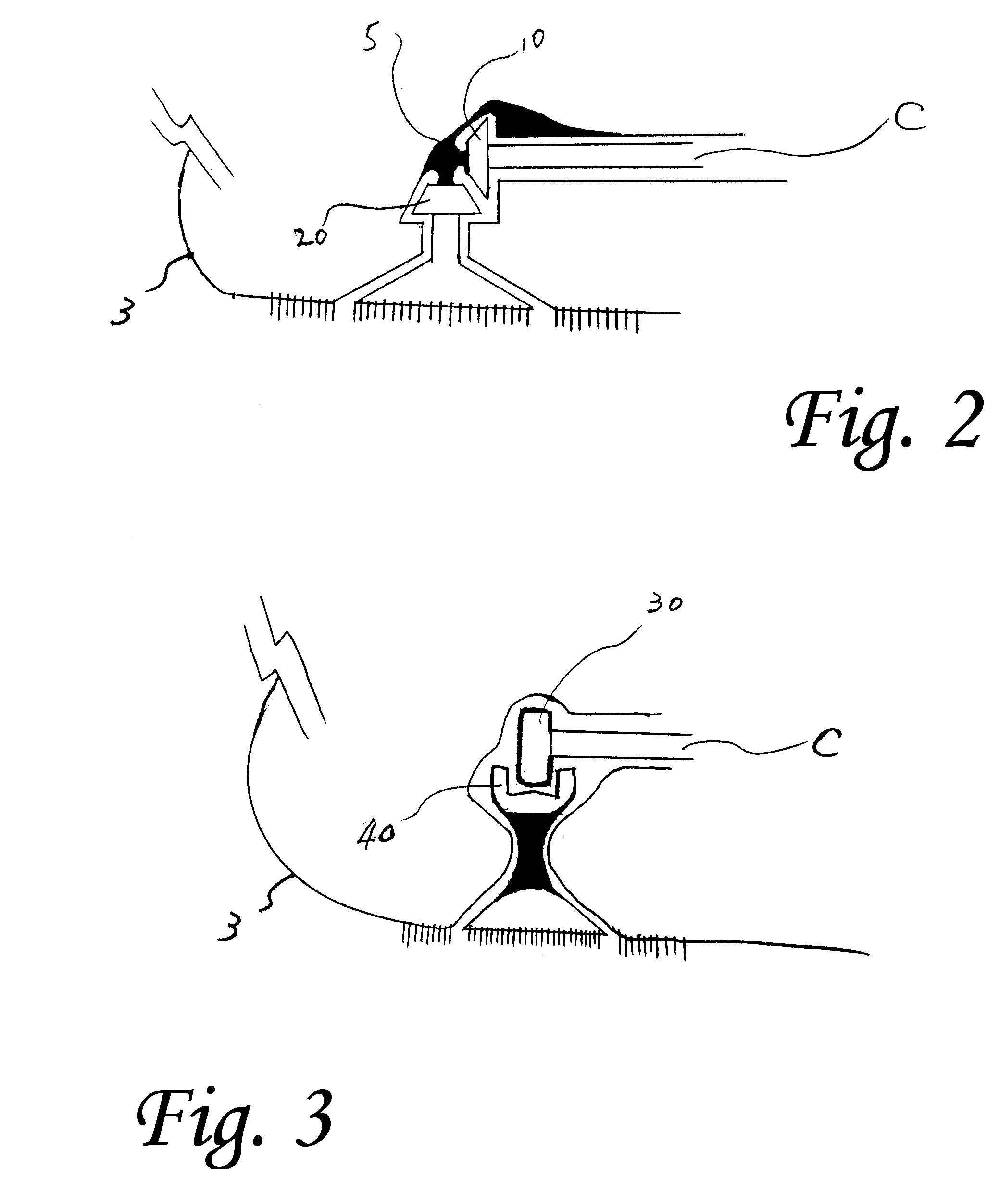 Toothbrush with moving bristle