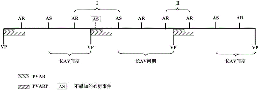 Low power consumption method for realization of mode inverse conversion of implantable pacemaker