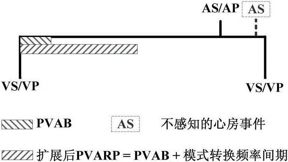 Low power consumption method for realization of mode inverse conversion of implantable pacemaker