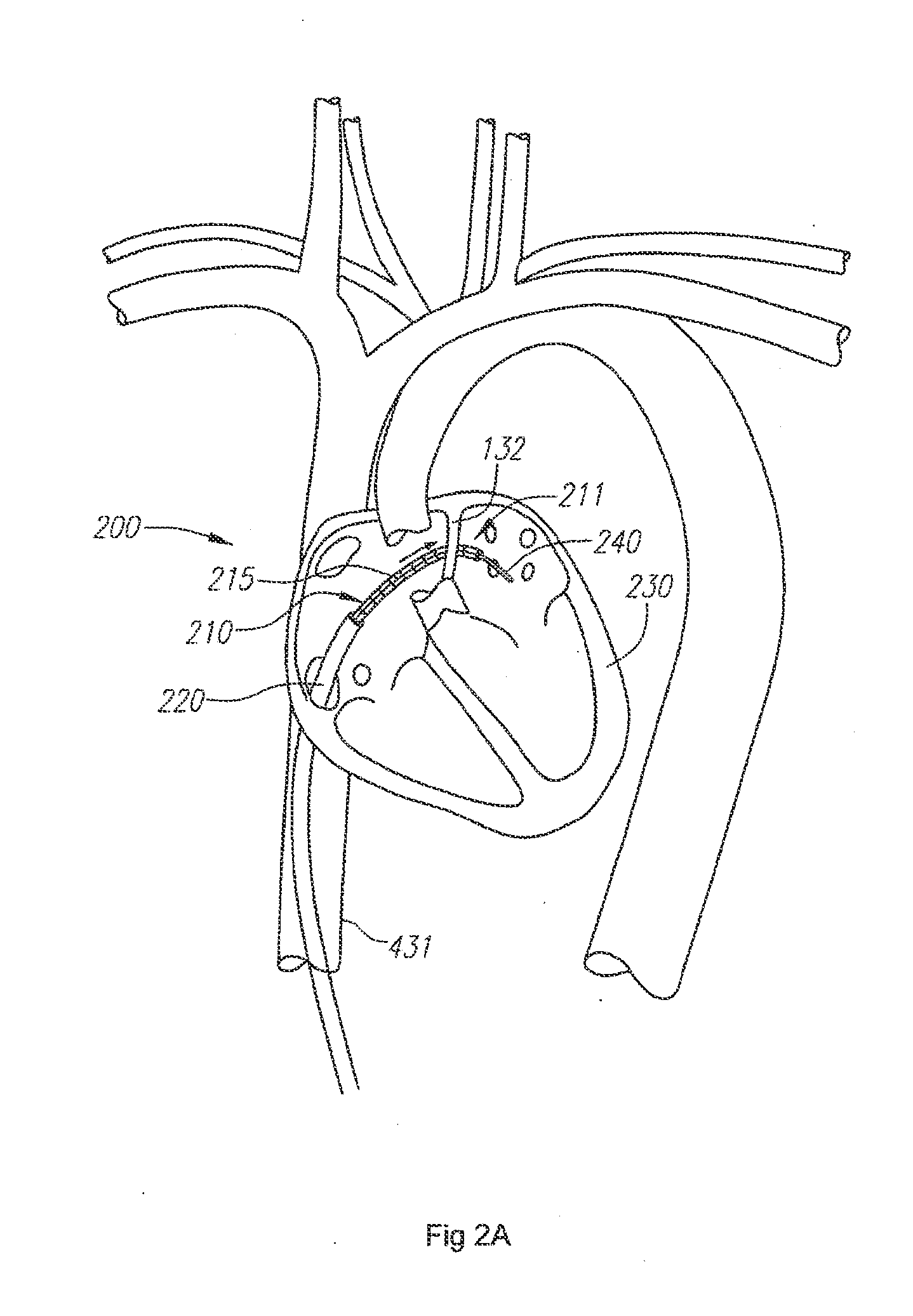 System and method for sensing shape of elongated instrument