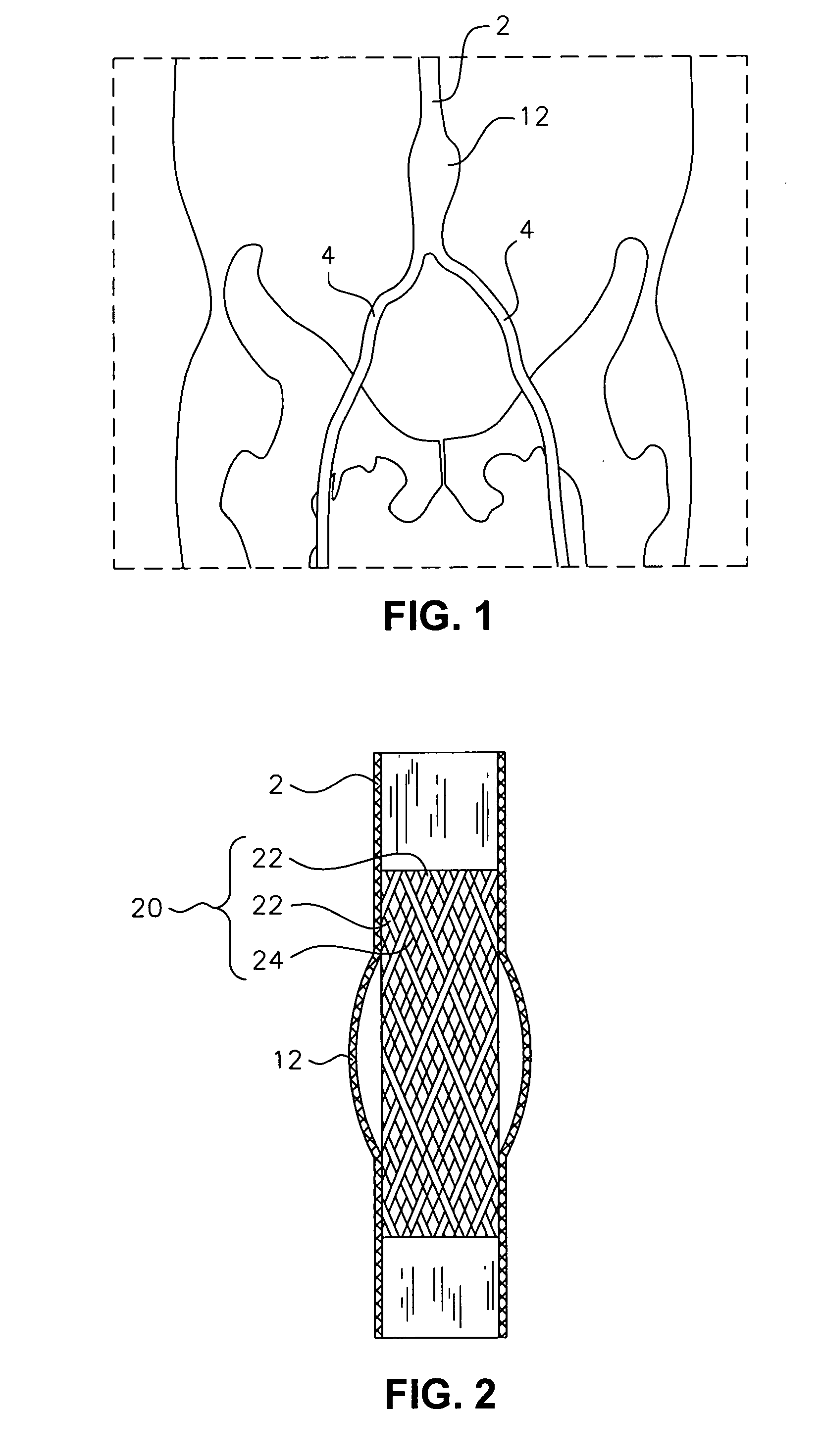 Devices and methods for AAA management