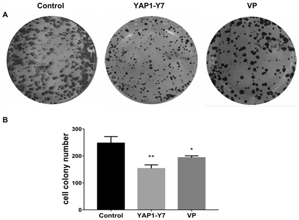 Small-molecule inhibitor YAP1-Y7 for YAP1, and application thereof